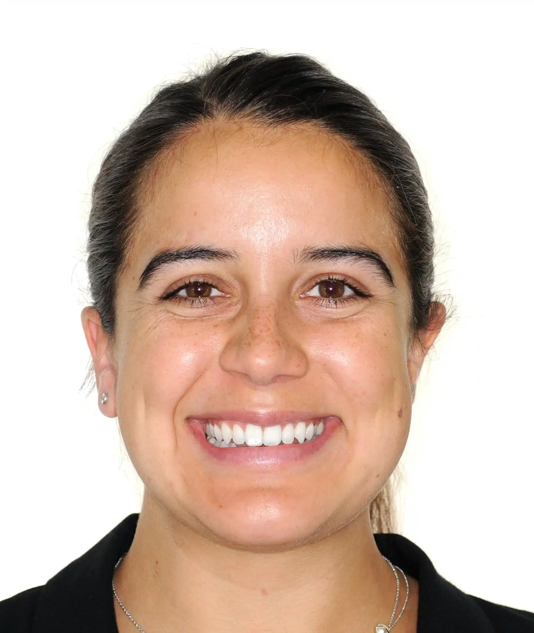 130950 - 9-22-2018 progress relapse going into treatment with INvisalign - 130950 - Ines Castro - Progress 39 - Facial Front Smiling.jpg