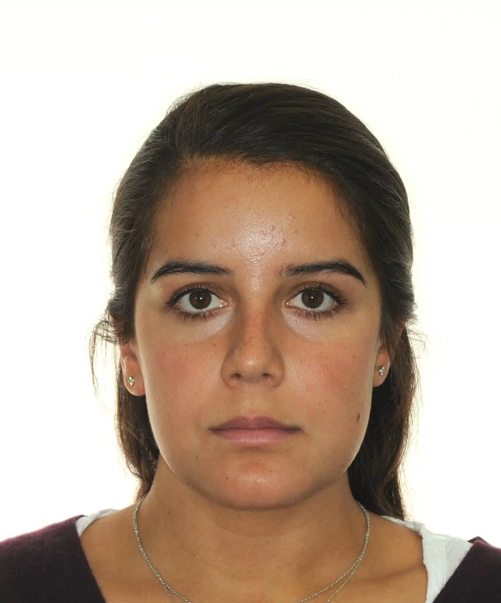 130950- DEBOND 1-12-2025 1ST SET OF BRACES - 130950 - Ines Castro - Deband 11 - Facial Front.jpg