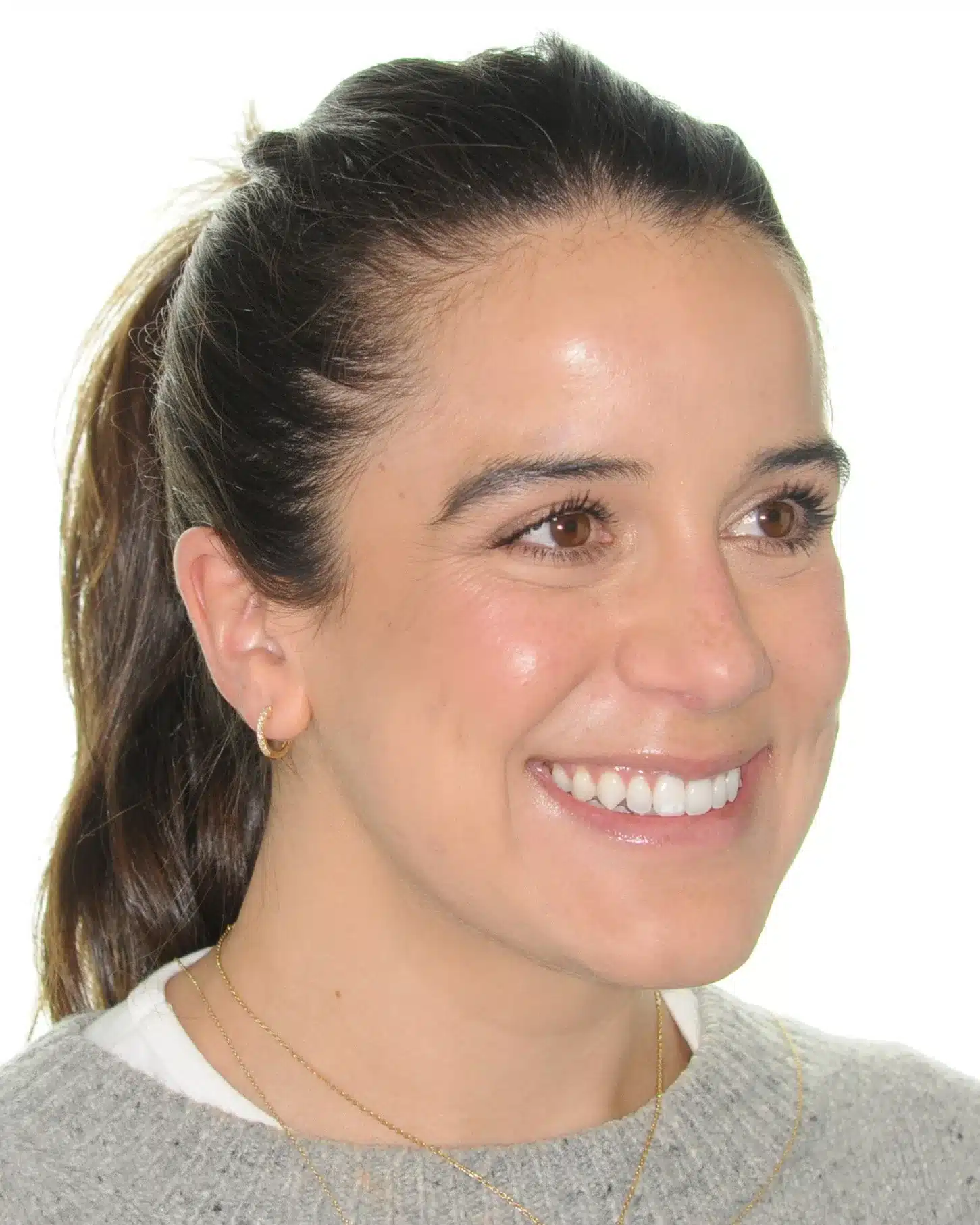 130950- Final 3-19-2024 - 130950 - Ines Castro - Invisalign 31_31 - Facial 34 R.jpg