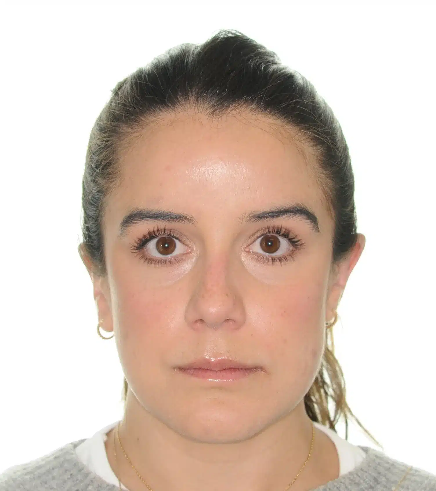 130950- Final 3-19-2024 - 130950 - Ines Castro - Invisalign 31_31 - Facial Front.jpg
