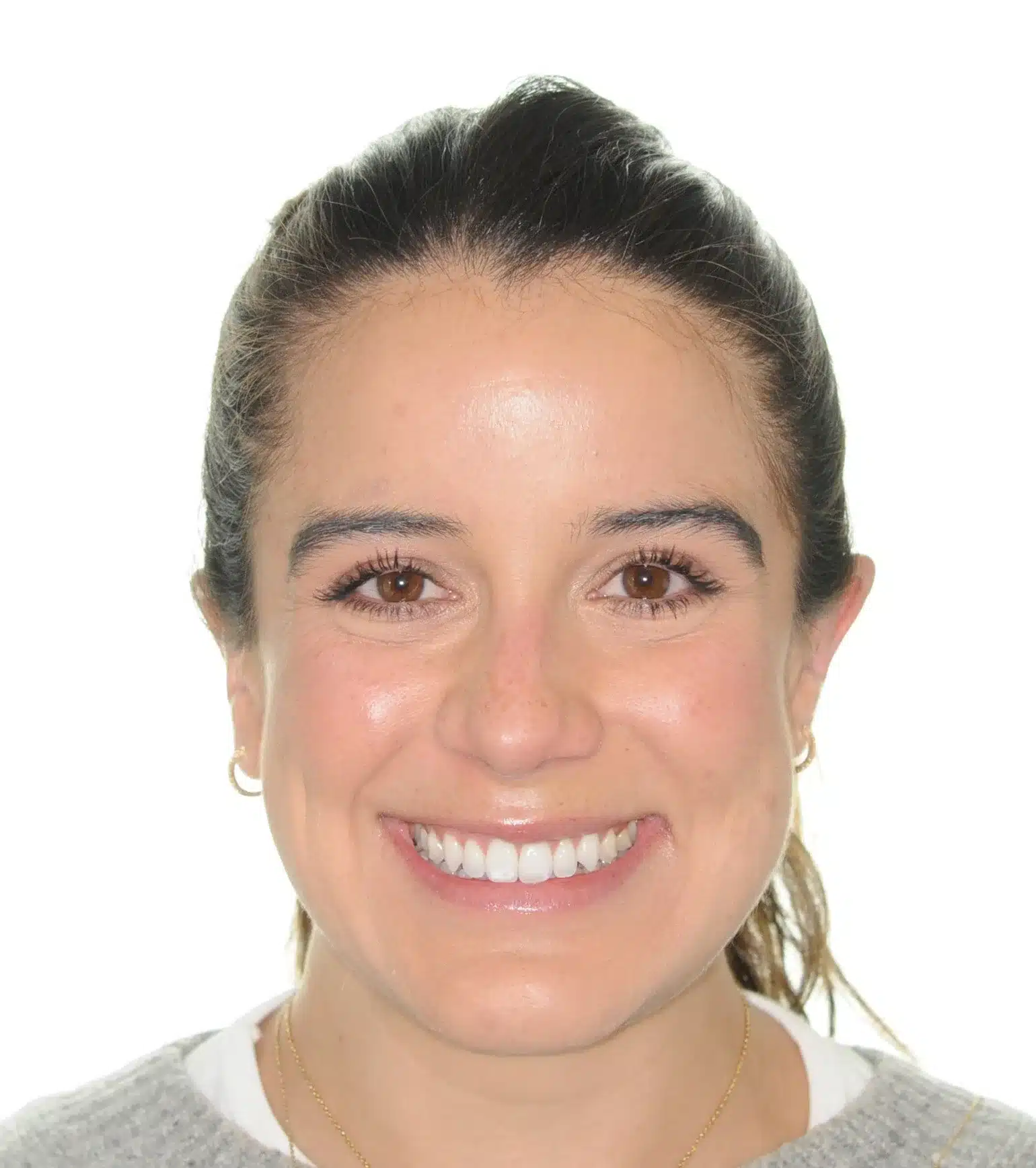 130950- Final 3-19-2024 - 130950 - Ines Castro - Invisalign 31_31 - Facial Front Smiling.jpg