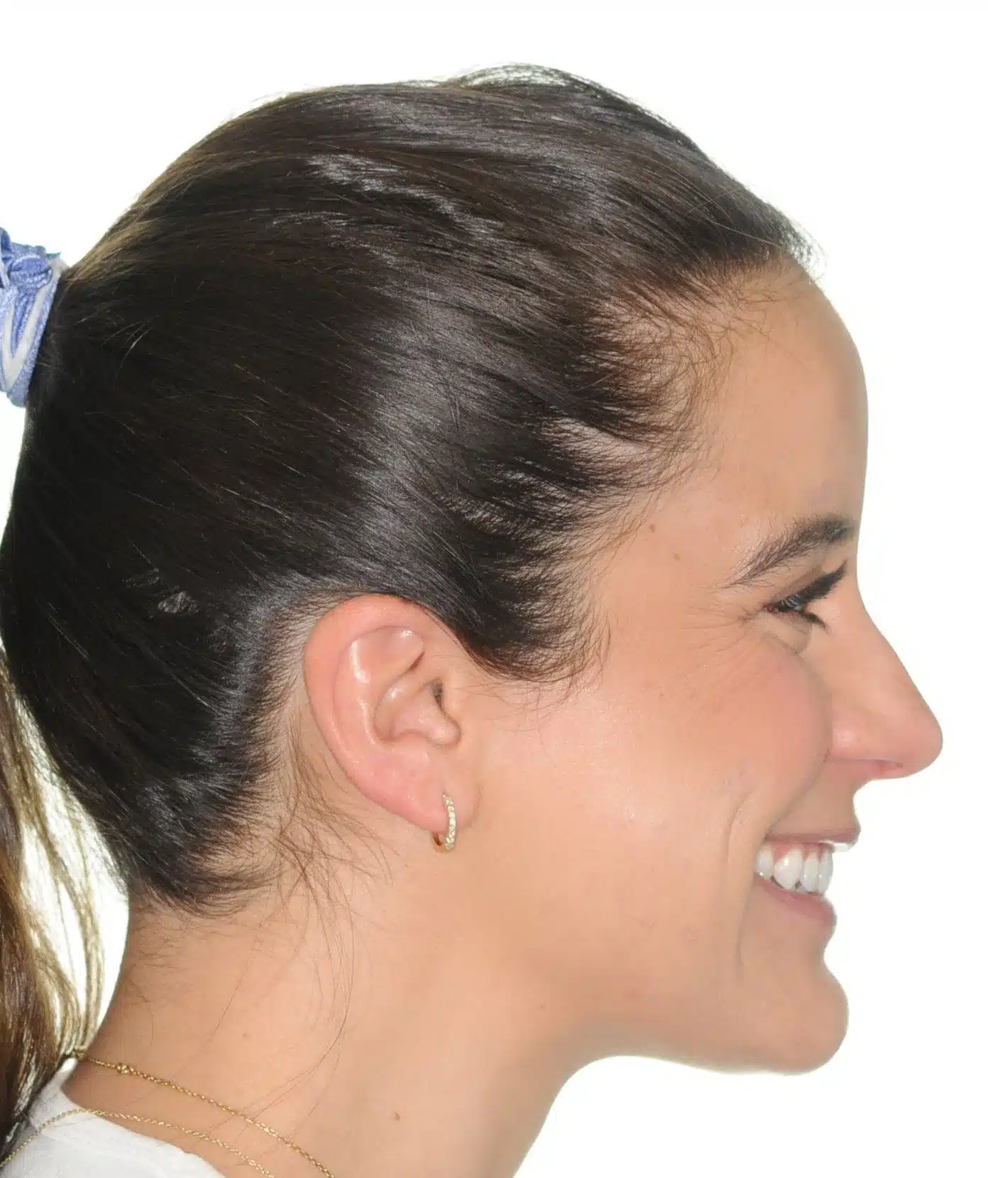 130950- Final 3-19-2024 - 130950 - Ines Castro - Invisalign 31_31 - Facial Profile Smiling.jpg