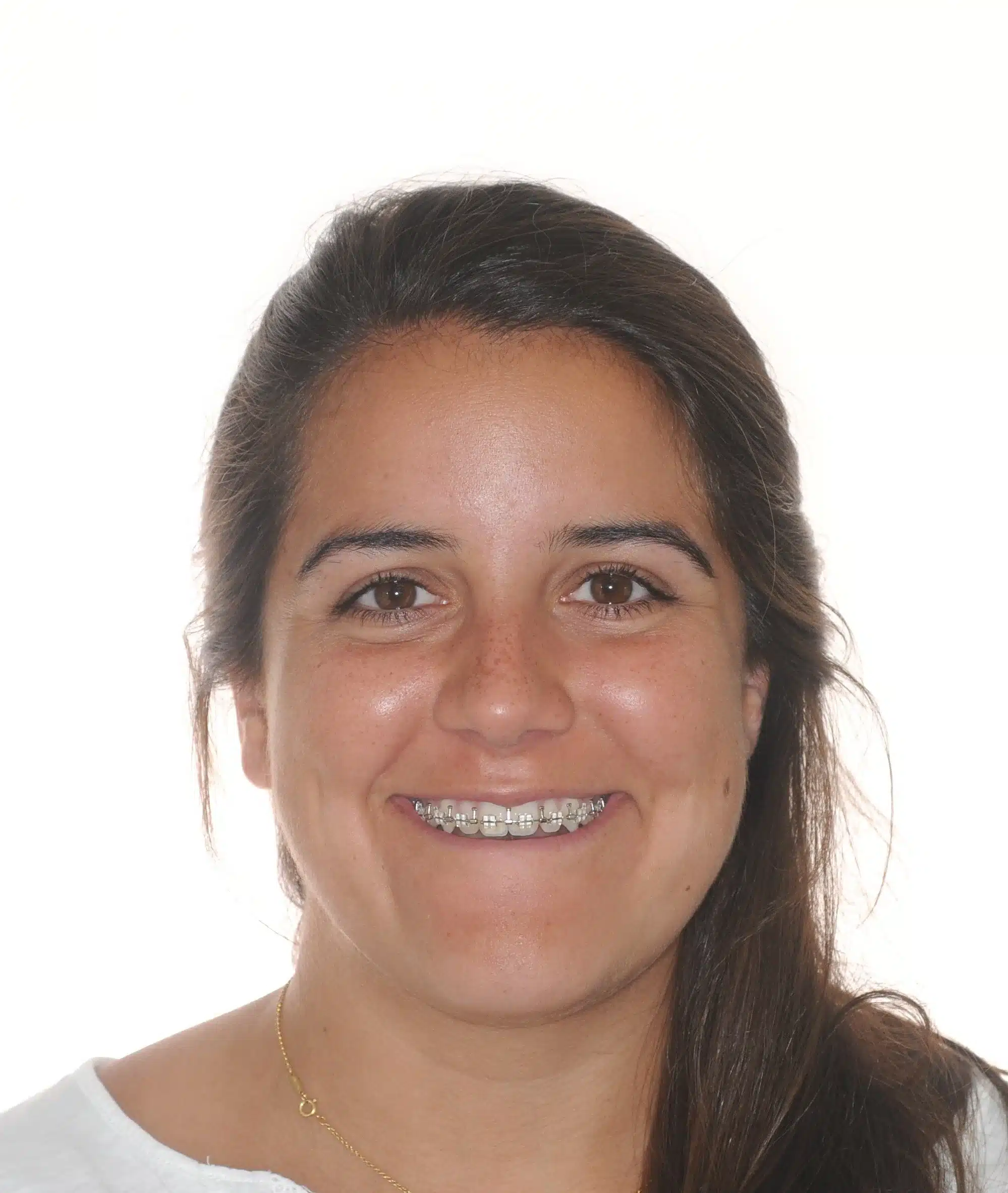 130950 - Ines Castro - progress 11 - Facial Front Smiling.jpg