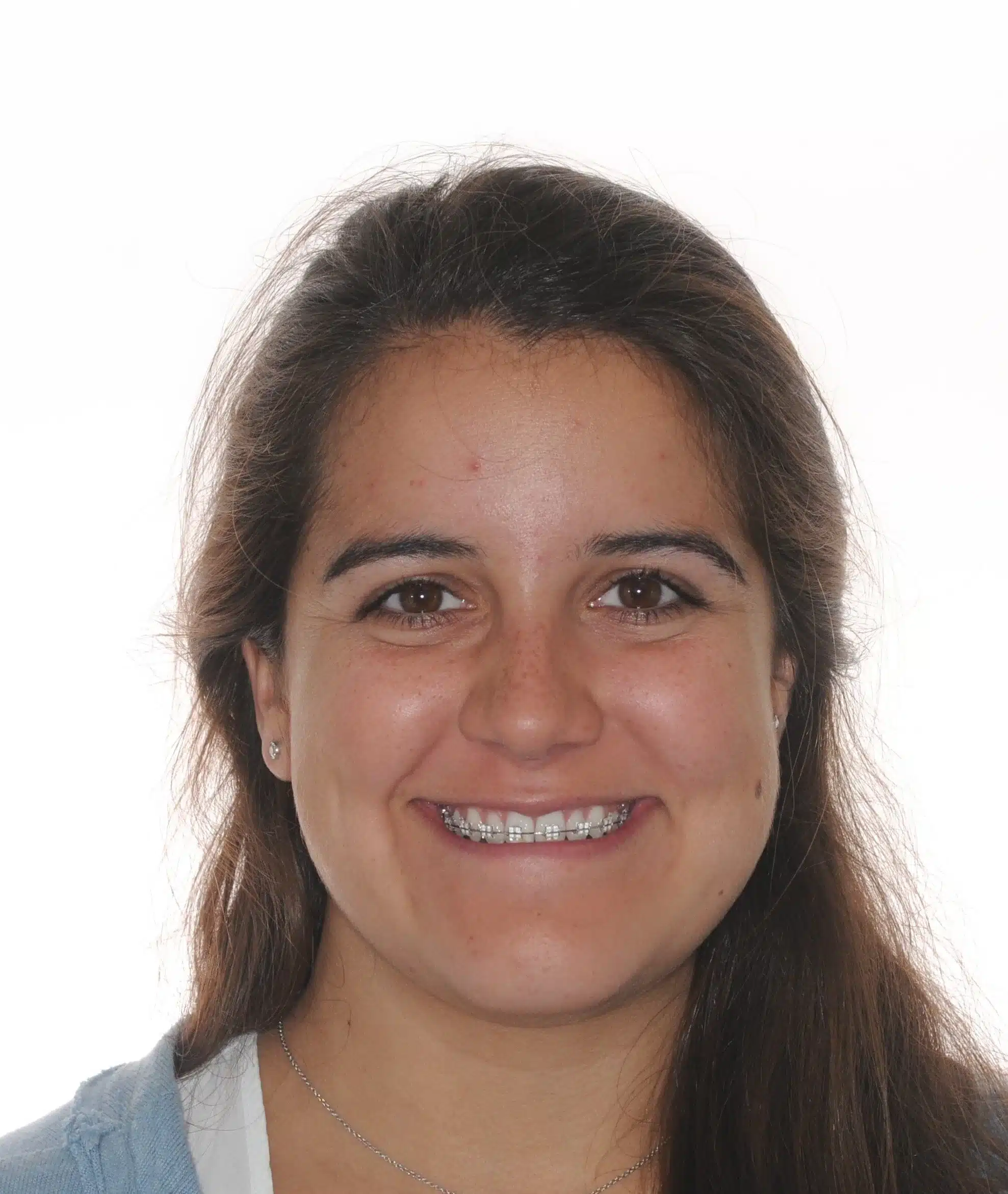 130950 - Ines Castro - progress 11 - Facial Front Smiling.jpg