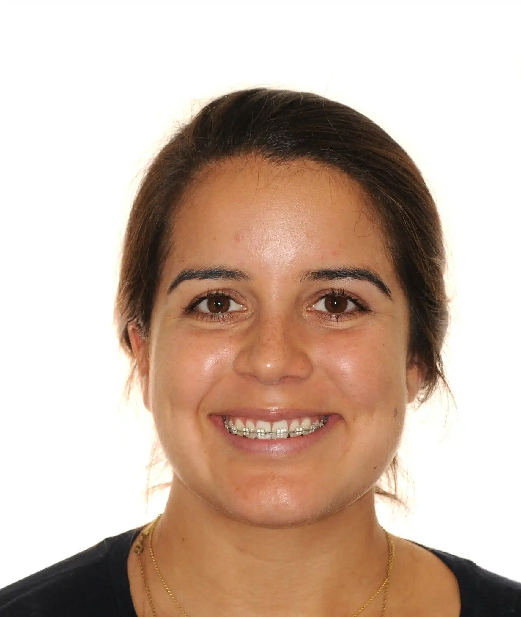 130950 - Ines Castro - progress 11 - Facial Front Smiling.jpg