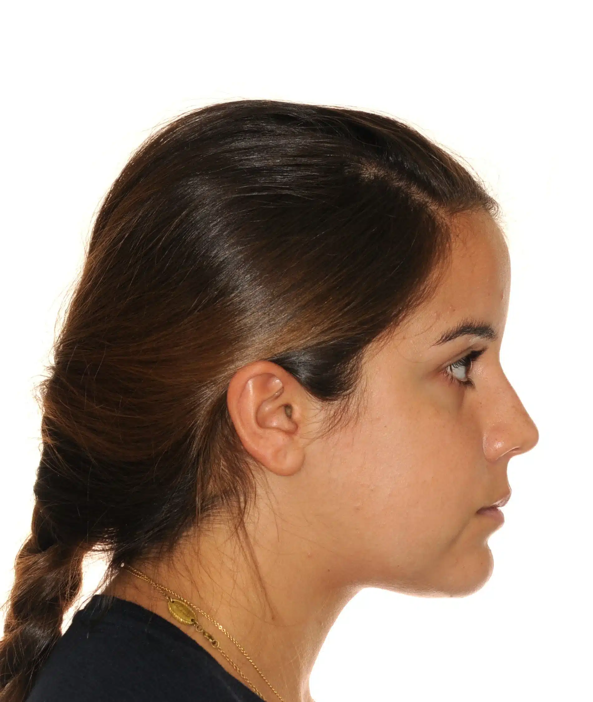 130950 - Ines Castro - progress 11 - Facial Profile.jpg