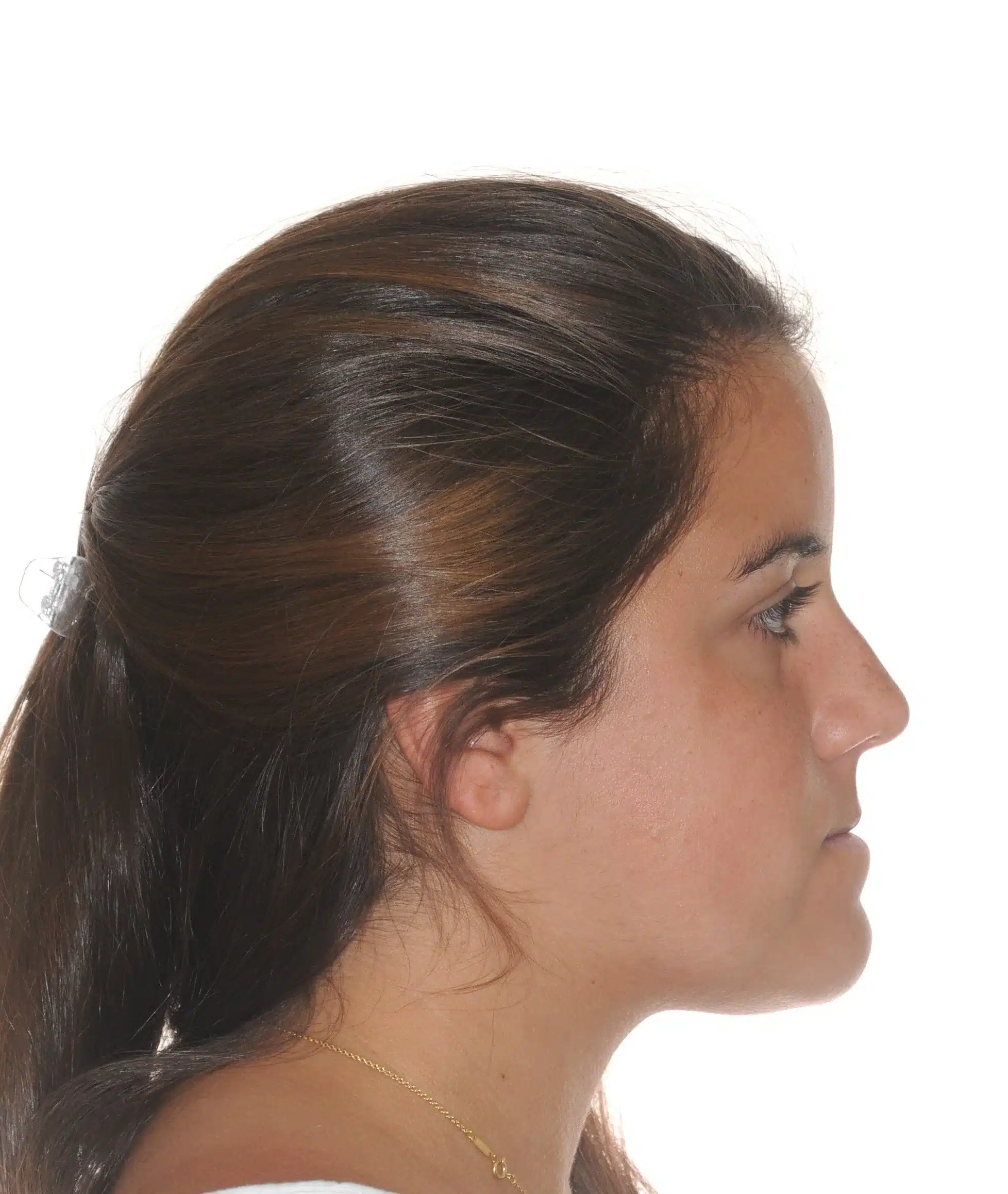 130950 - Ines Castro - progress 11 - Facial Profile.jpg