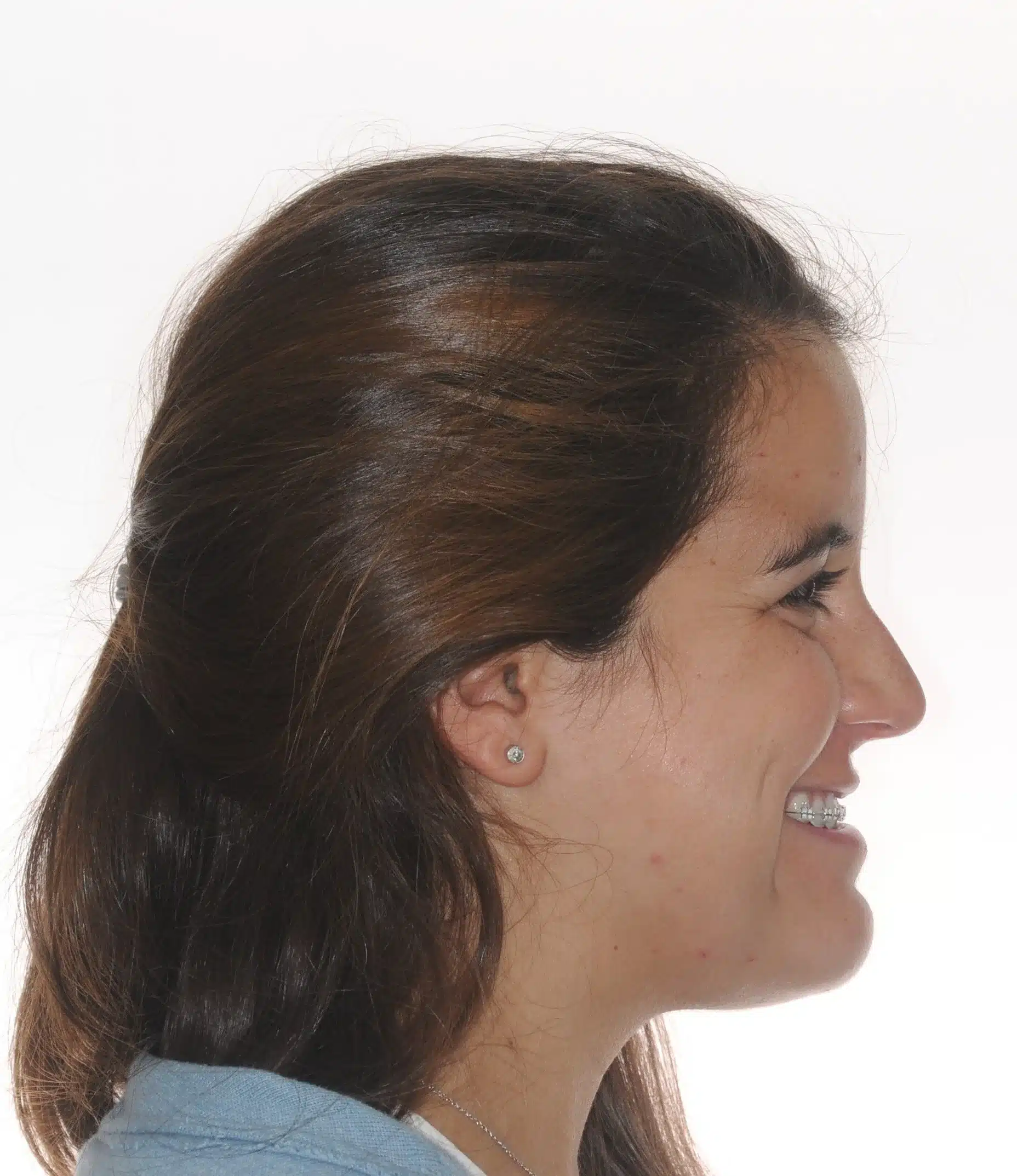 130950 - Ines Castro - progress 11 - Facial Profile Smiling.jpg