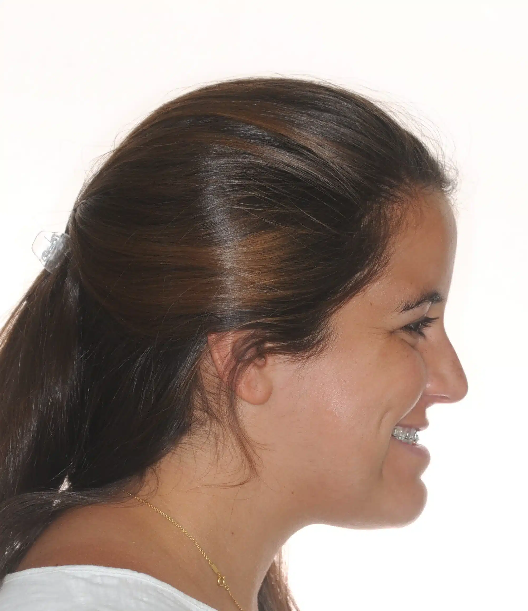 130950 - Ines Castro - progress 11 - Facial Profile Smiling.jpg