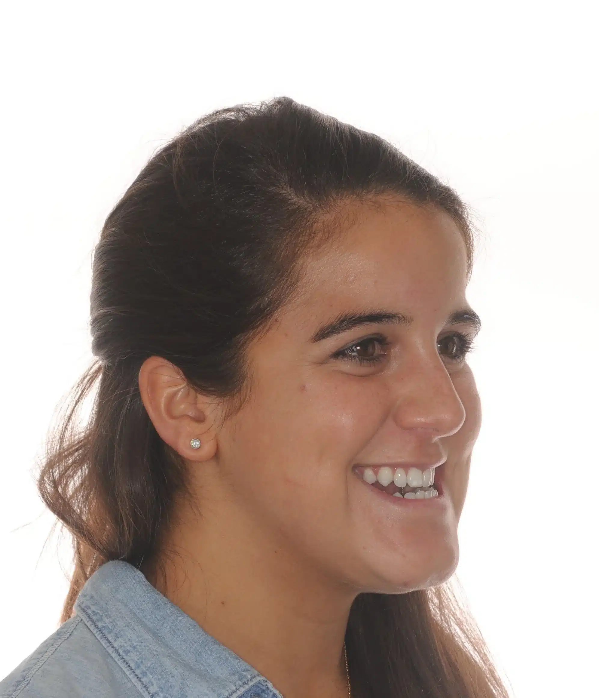 130950- INITIAL 11-23-13 - 130950 - Ines Castro - initial 11 - Facial 34 R.jpg