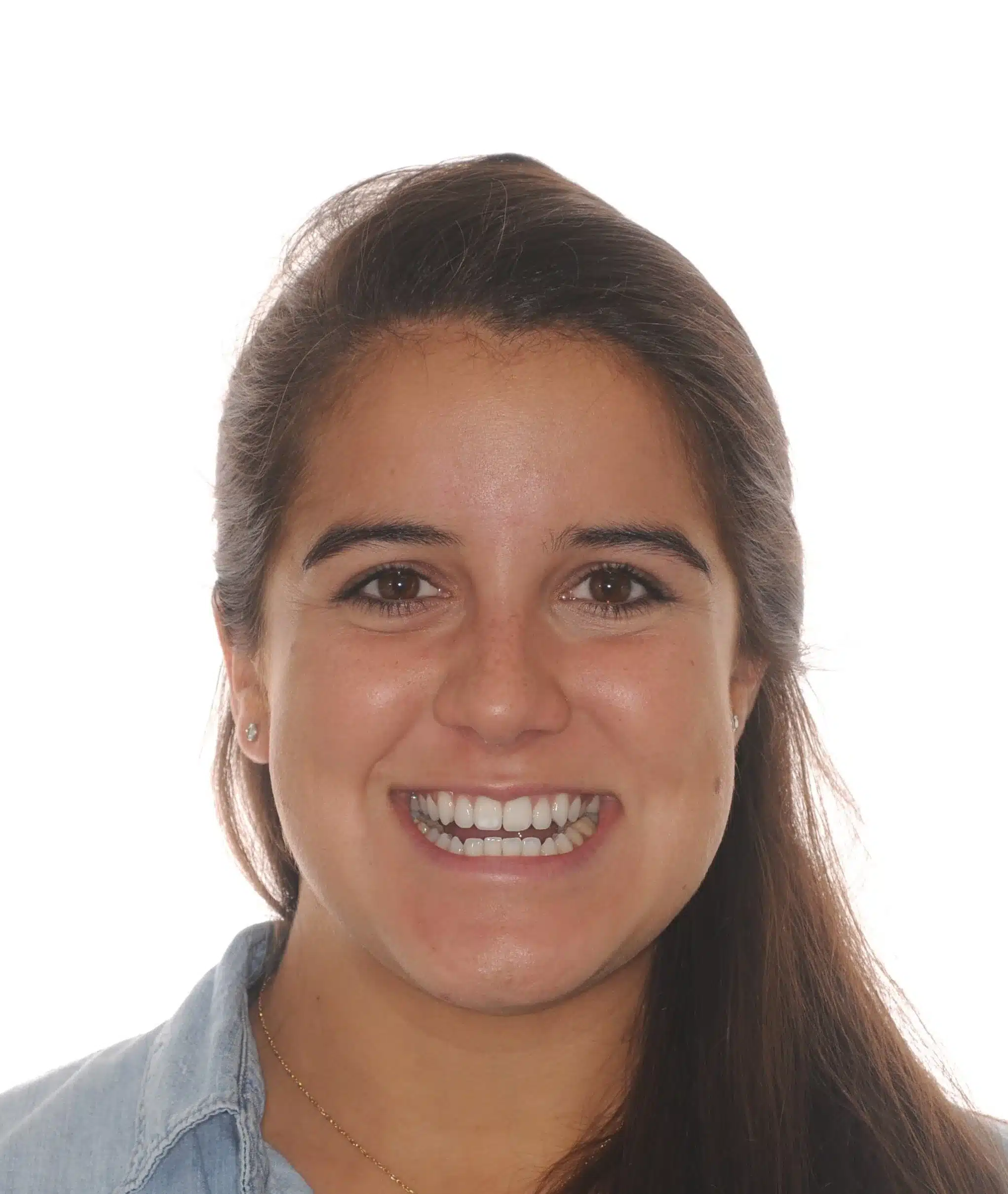 130950- INITIAL 11-23-13 - 130950 - Ines Castro - initial 11 - Facial Front Smiling.jpg