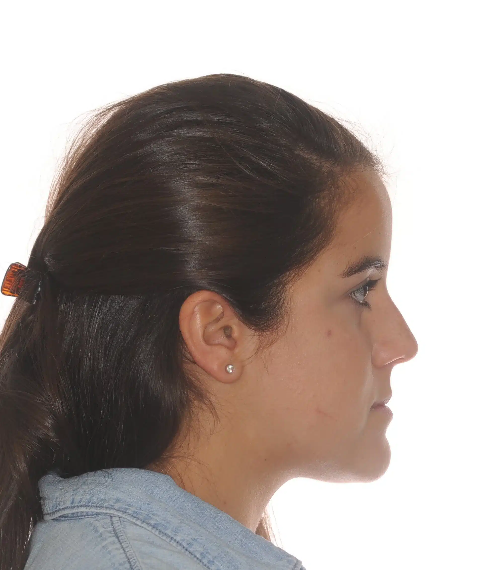 130950- INITIAL 11-23-13 - 130950 - Ines Castro - initial 11 - Facial Profile.jpg