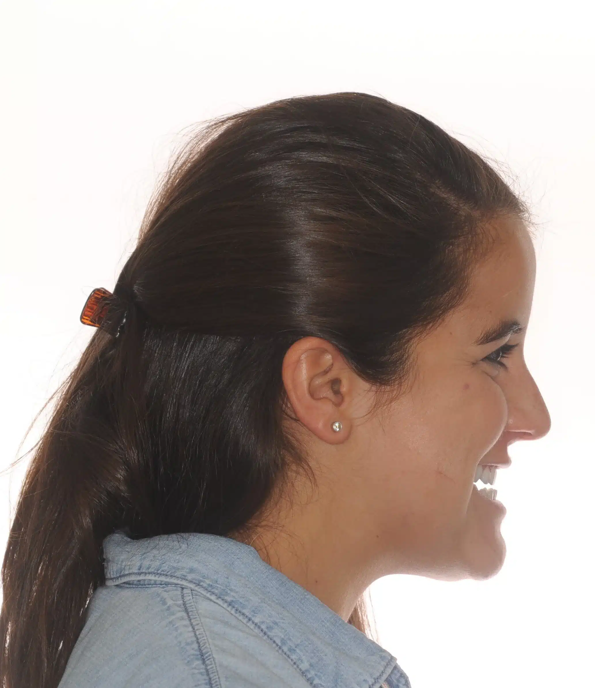 130950- INITIAL 11-23-13 - 130950 - Ines Castro - initial 11 - Facial Profile Smiling.jpg