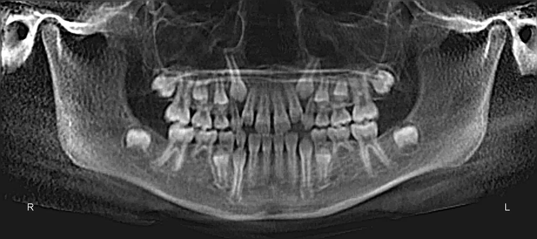 230370_00_i51.jpg