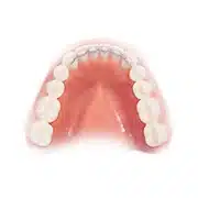 appliances_retainer.jpg