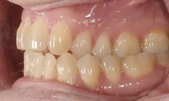 Best NYC Orthodontist 1.jpg