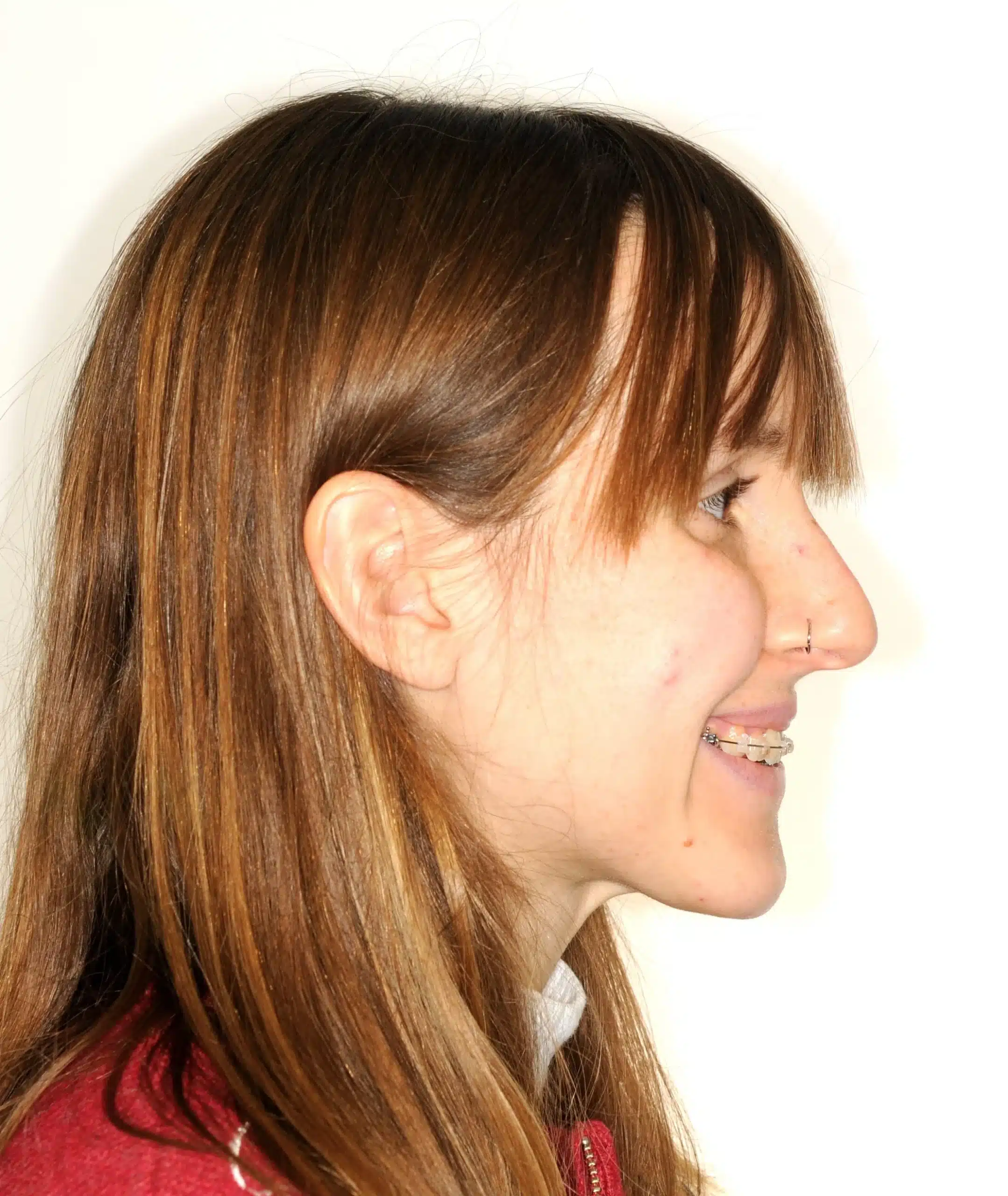 Best NYC Orthodontist 10.jpeg