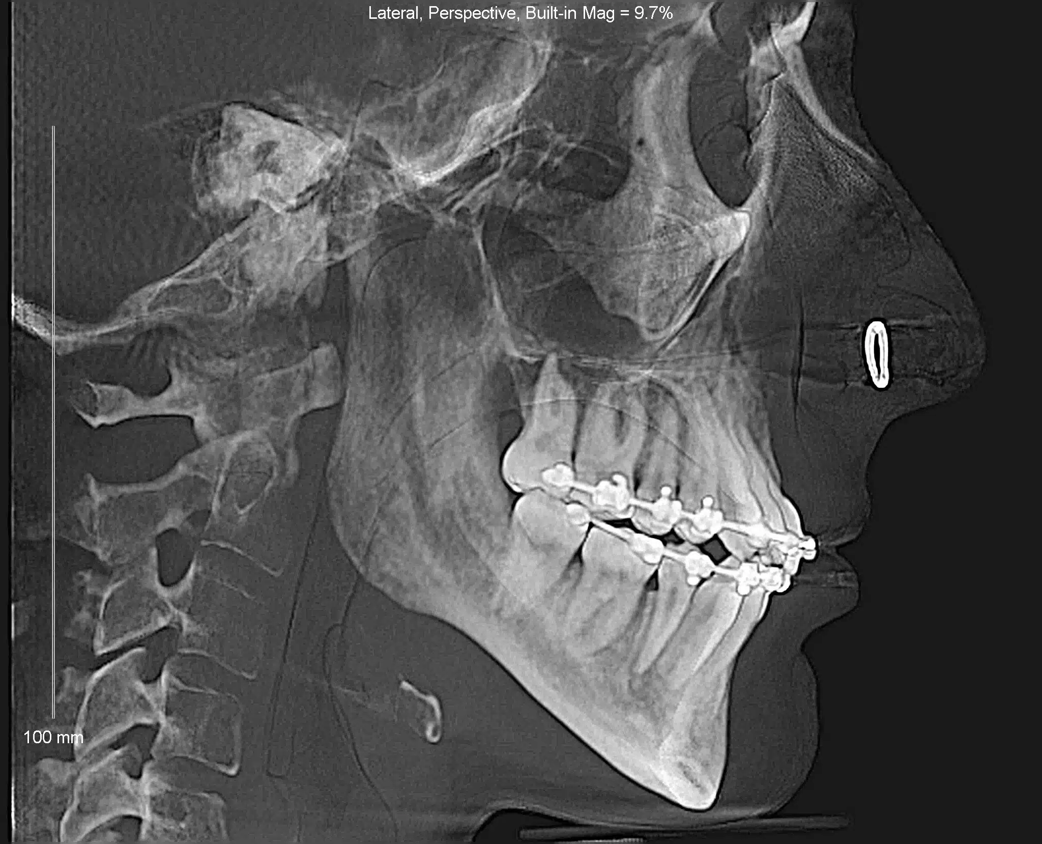 Best NYC Orthodontist 11.jpeg