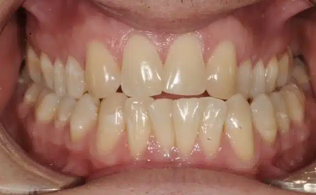 Best NYC Orthodontist 2.jpg