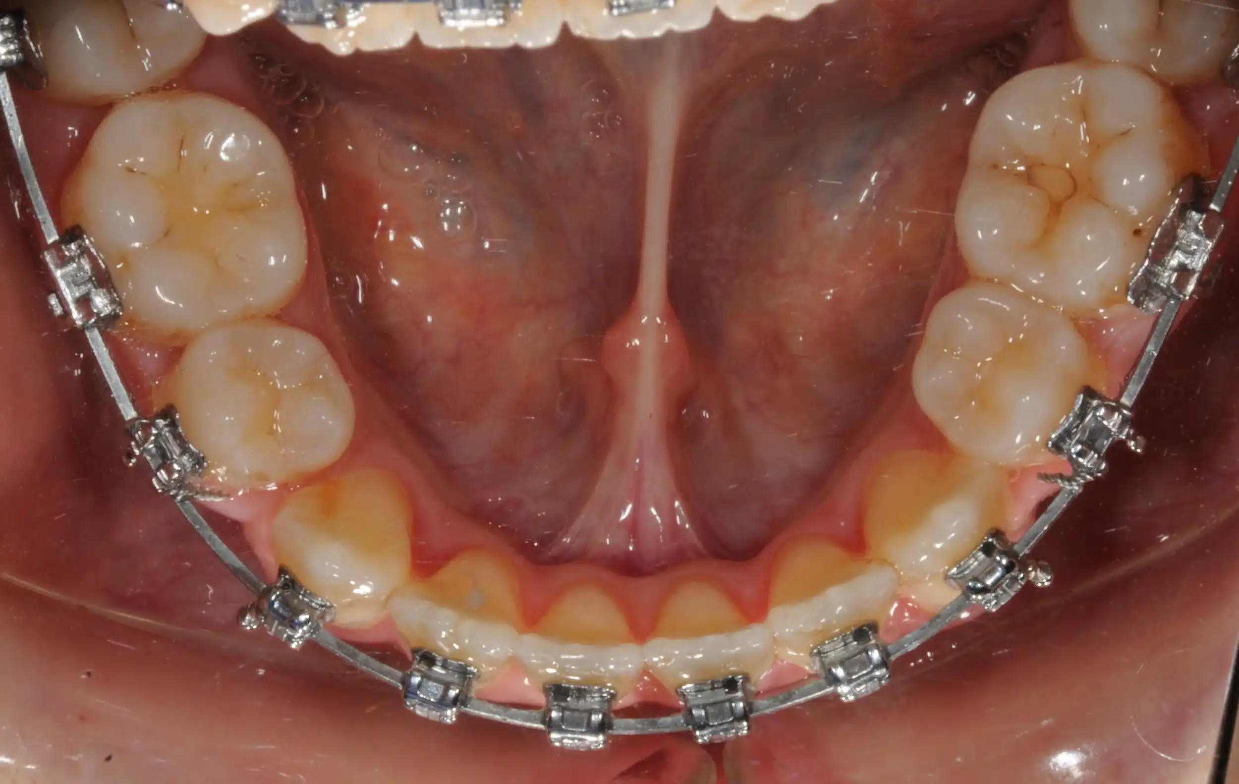 Best NYC Orthodontist 3.jpeg