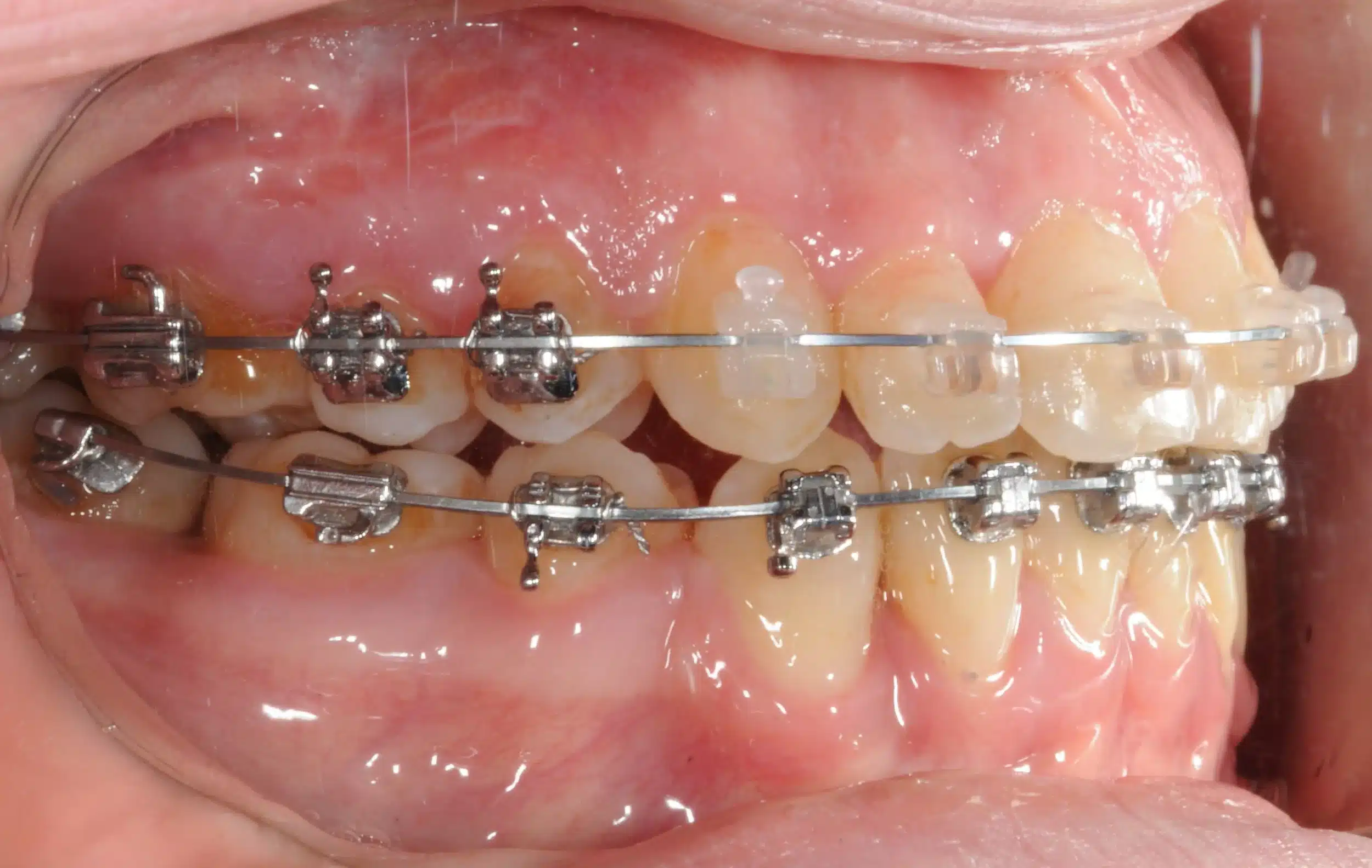 Best NYC Orthodontist 4.jpeg