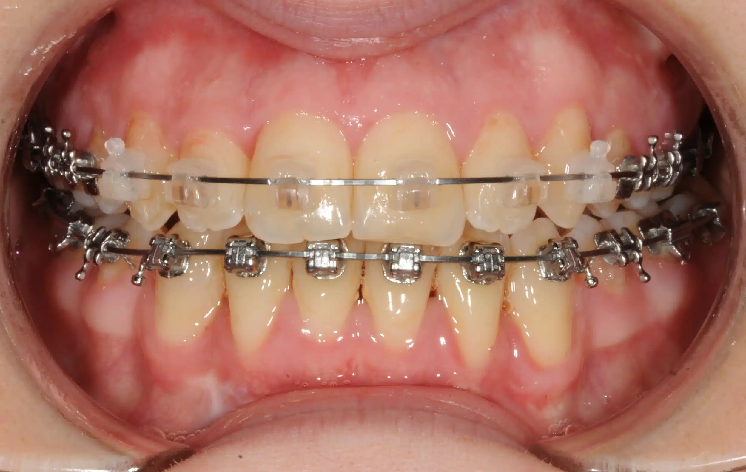 Best NYC Orthodontist 5.jpeg