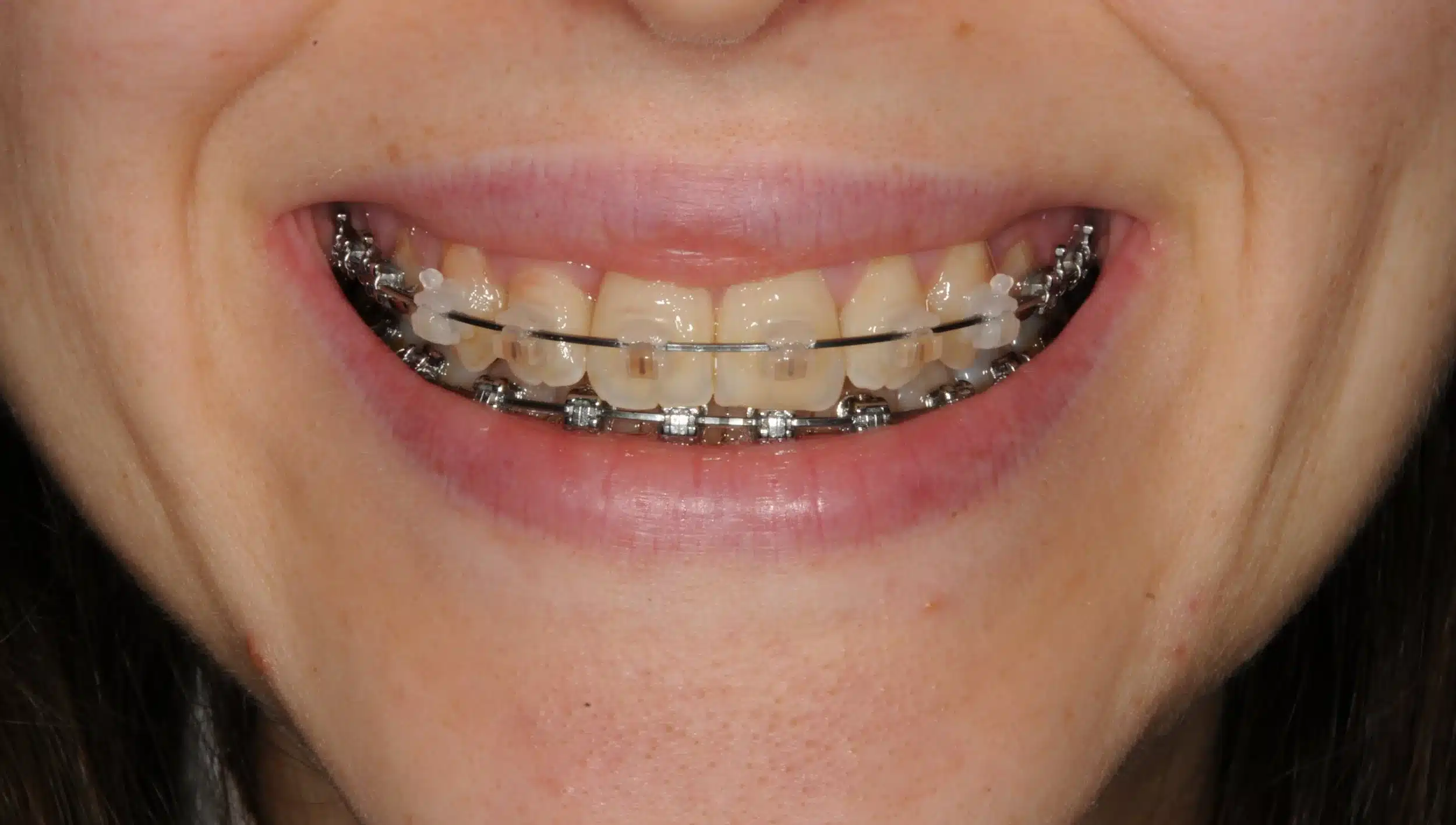 Best NYC Orthodontist 6.jpeg