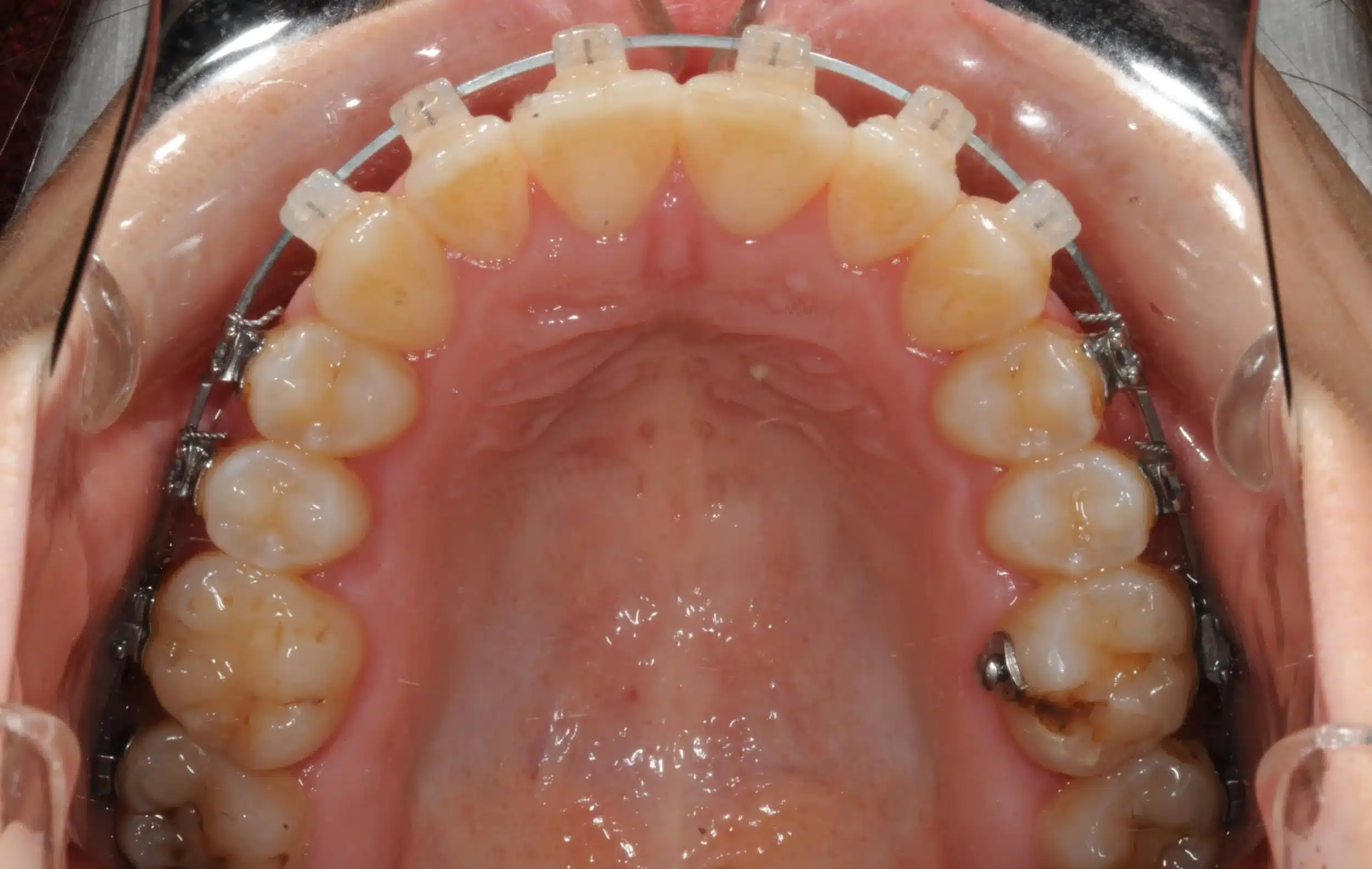 Best NYC Orthodontist 7.jpeg