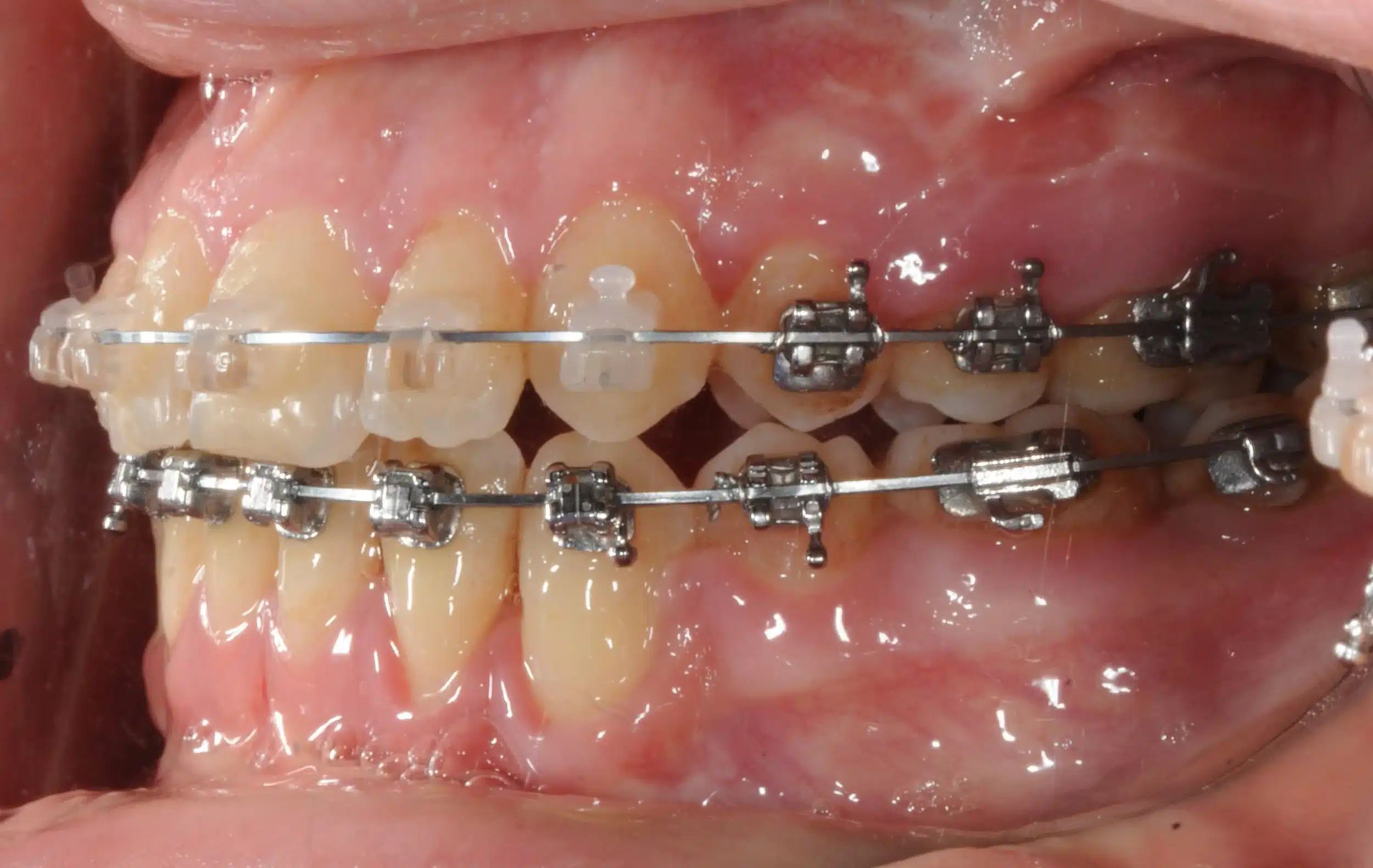 Best NYC Orthodontist 8.jpeg