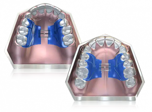 biobloc_numbered_3-627x460.png