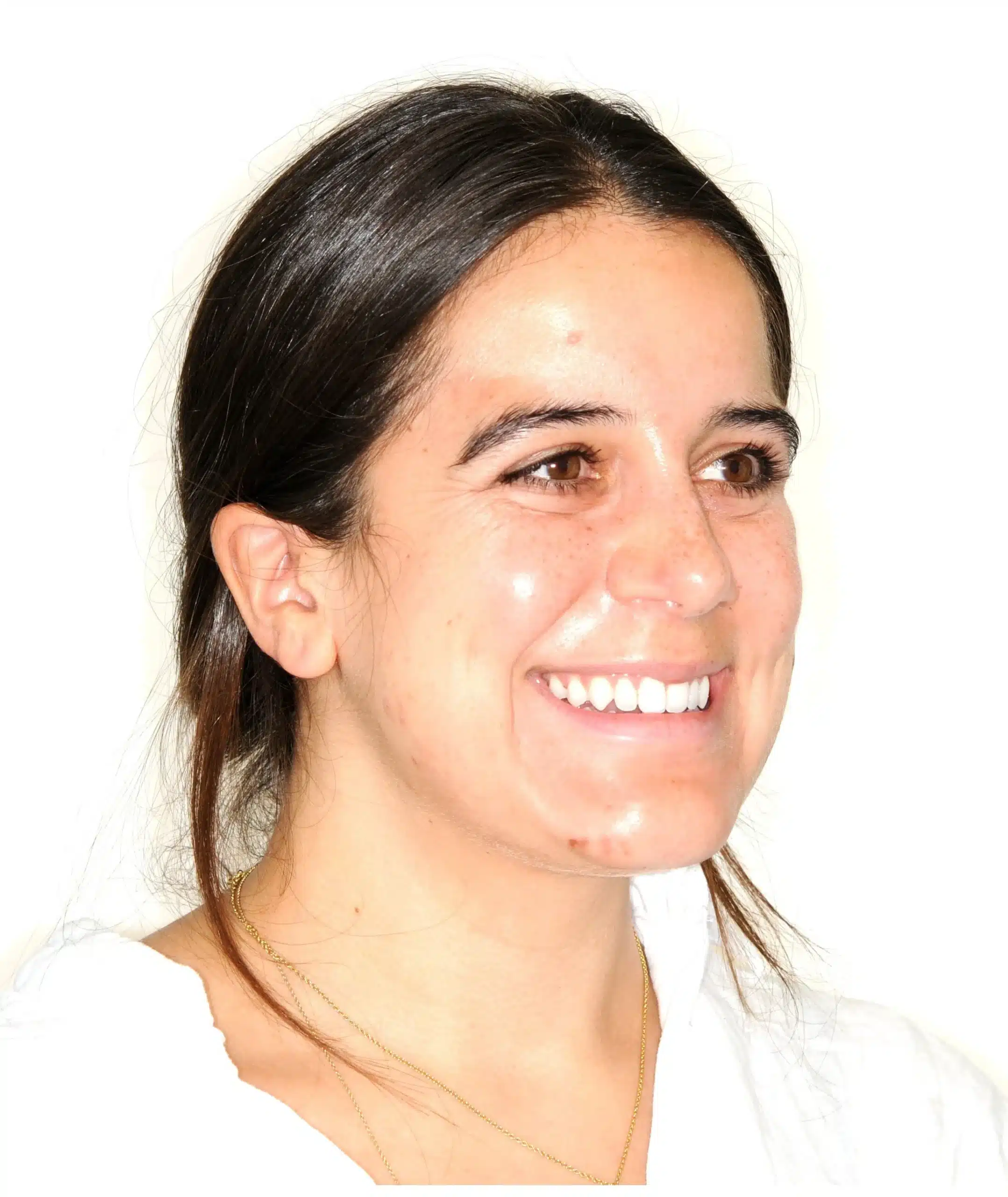 Invisalign begins in 2022 - 130950 - Ines Castro - Diagnostic 17 - Facial 34 R.jpg