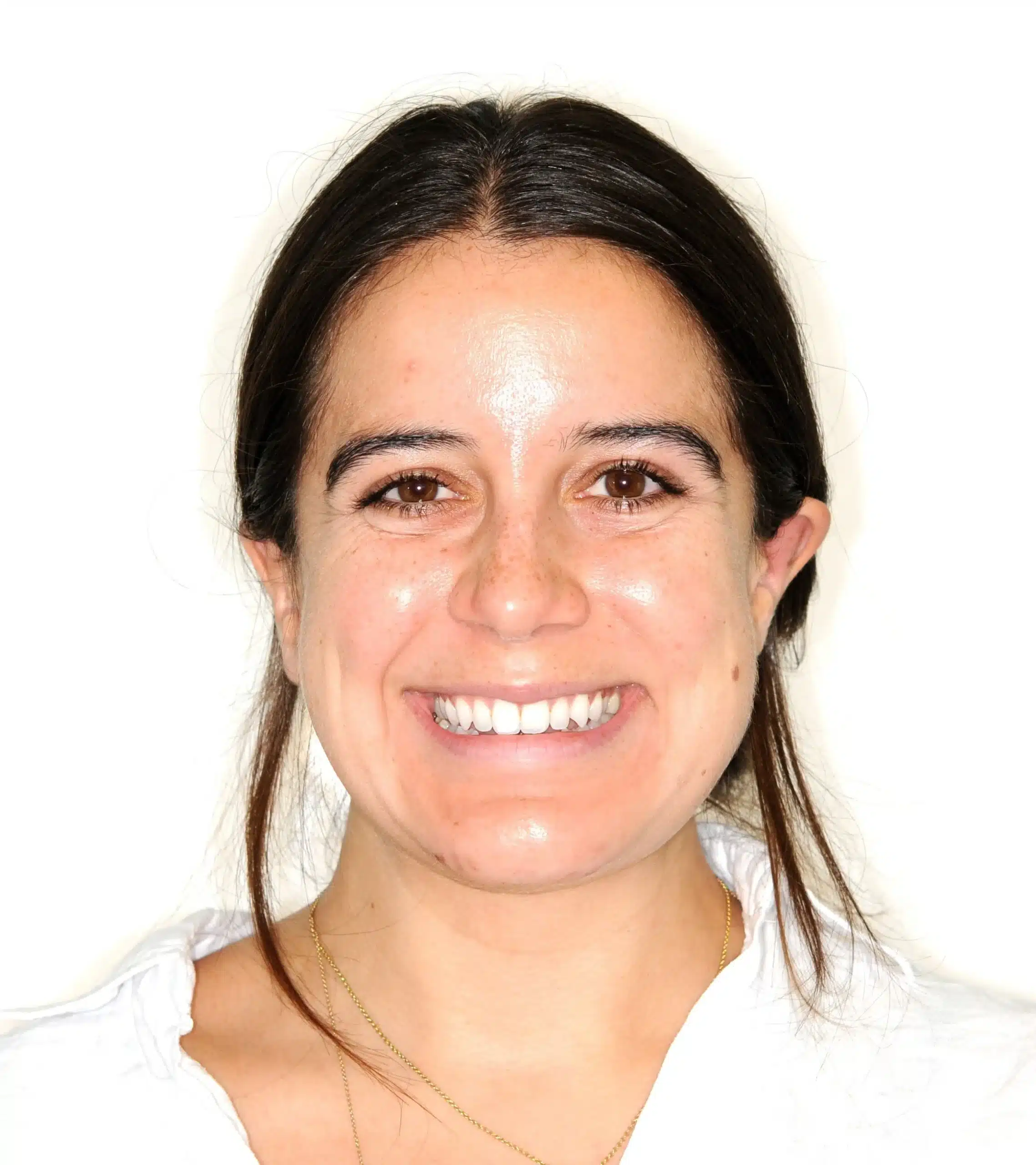 Invisalign begins in 2022 - 130950 - Ines Castro - Diagnostic 17 - Facial Front Smiling.jpg