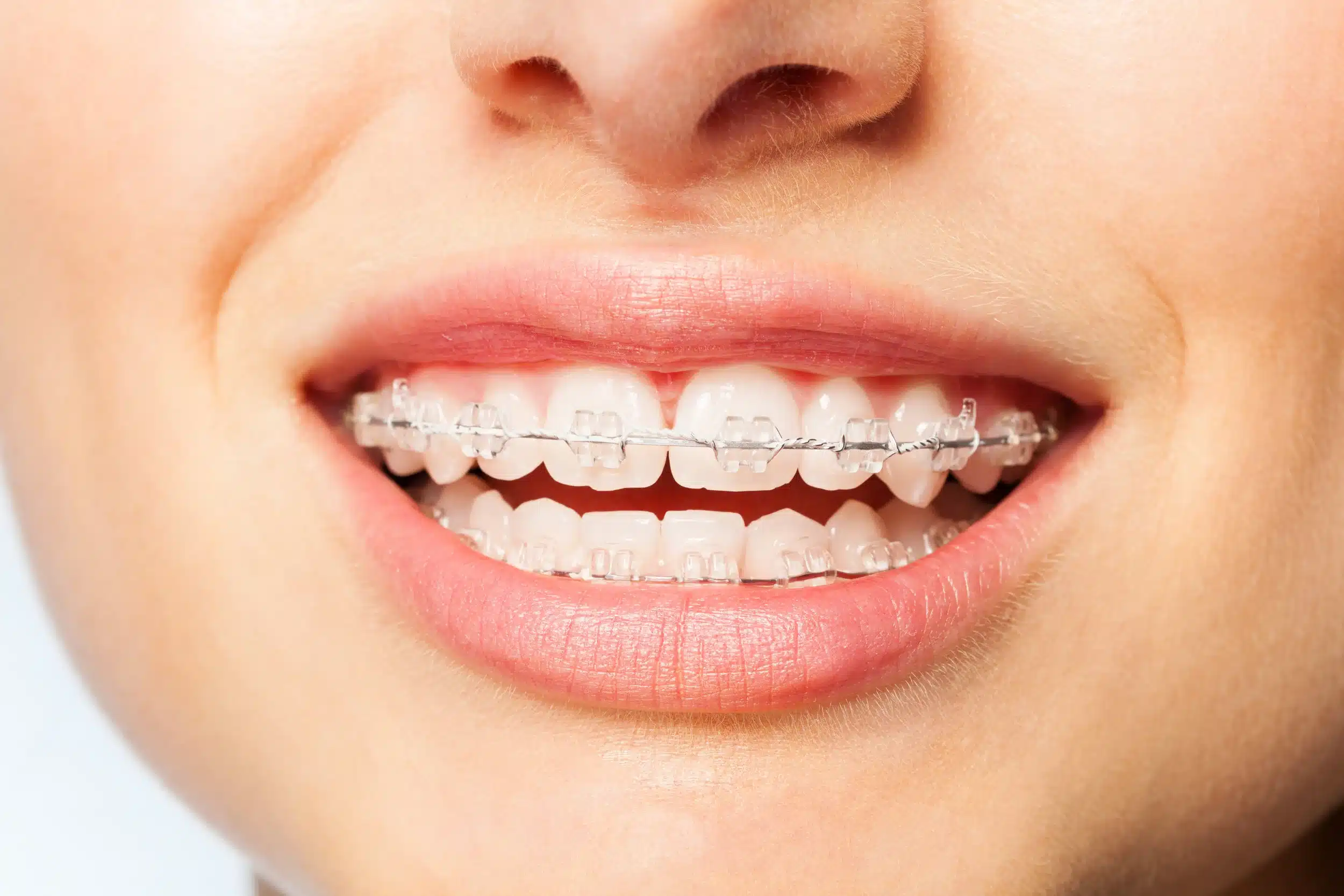 iStock-877381724.jpg