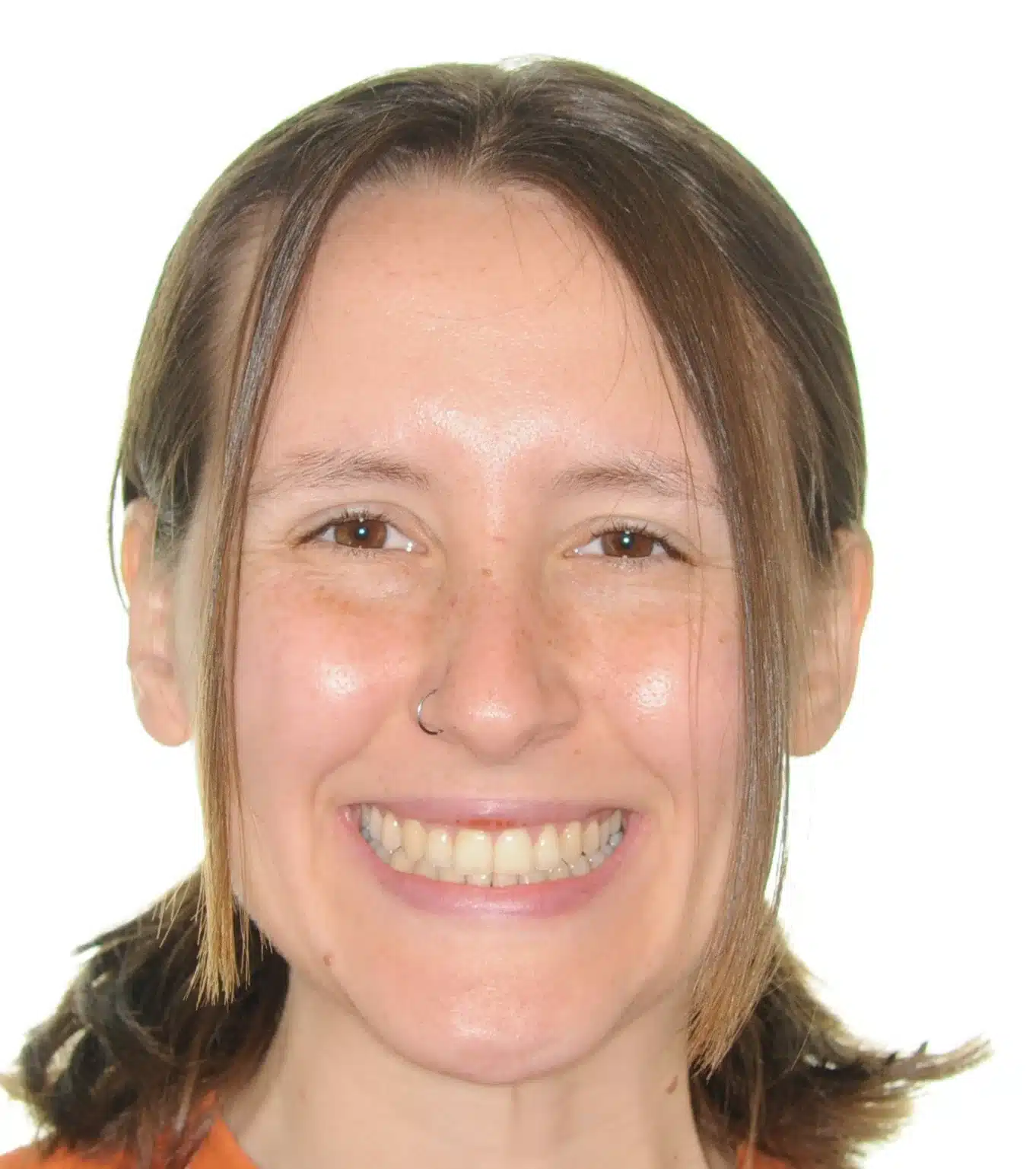 NYC Best Orthodontist 1 2.jpeg
