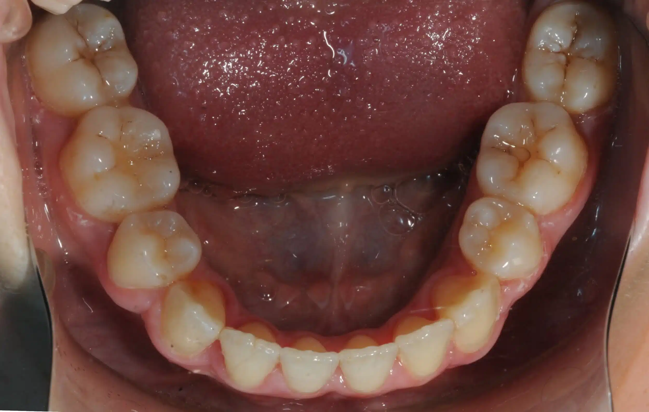 NYC Best Orthodontist 1 4.jpeg