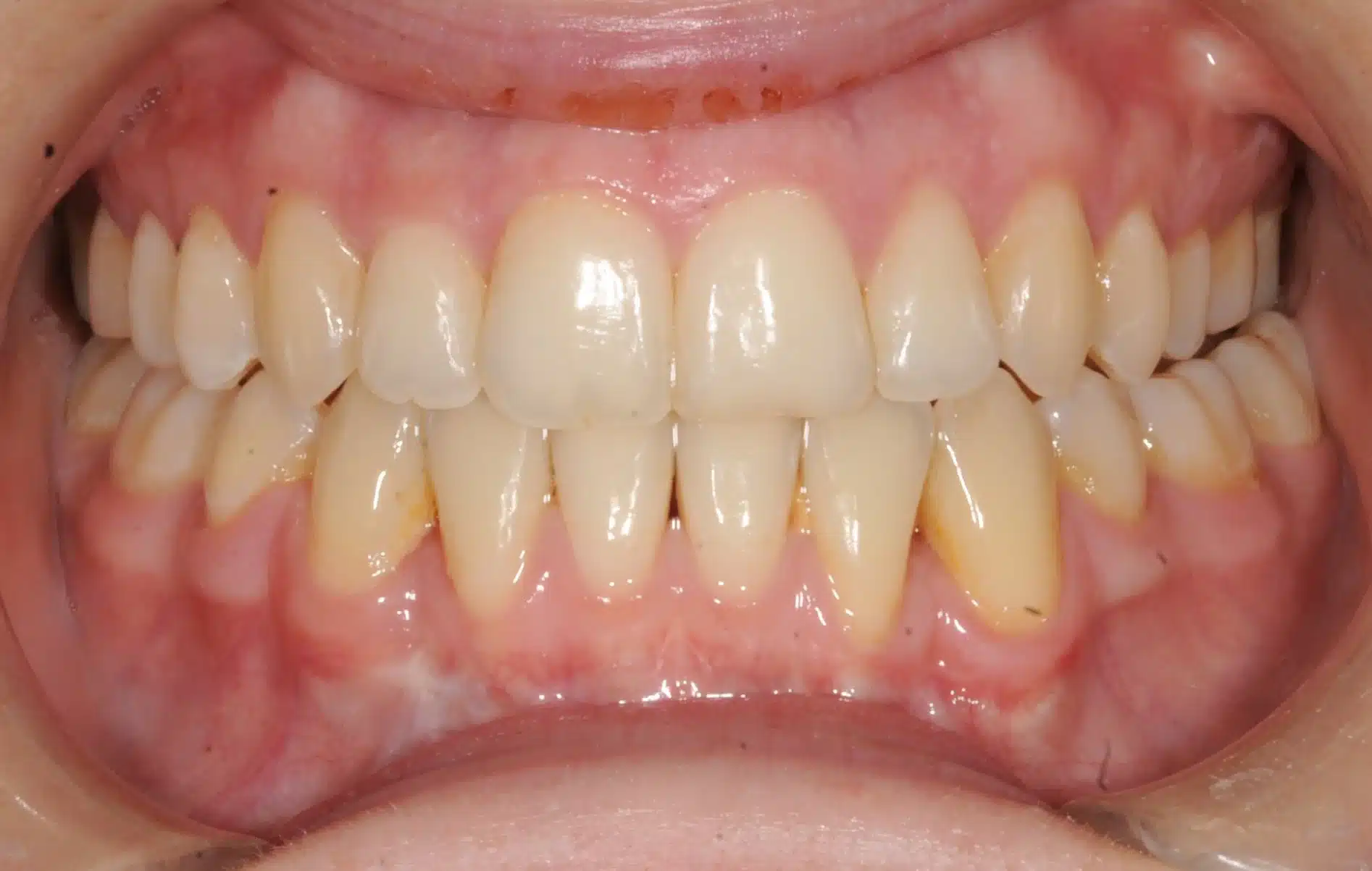 NYC Best Orthodontist 1.jpeg