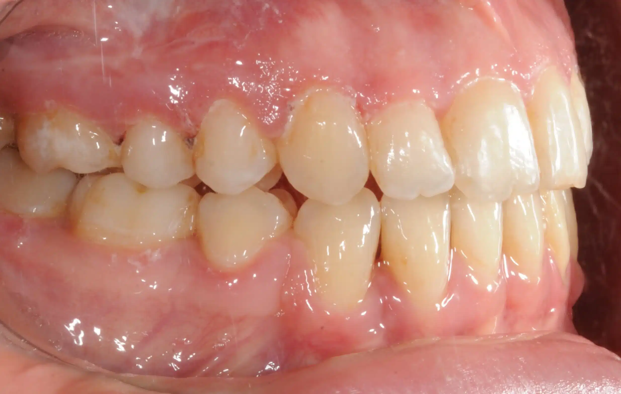 NYC Best Orthodontist 19.jpeg