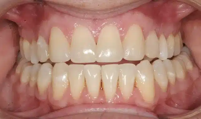 NYC Best Orthodontist 12.jpg