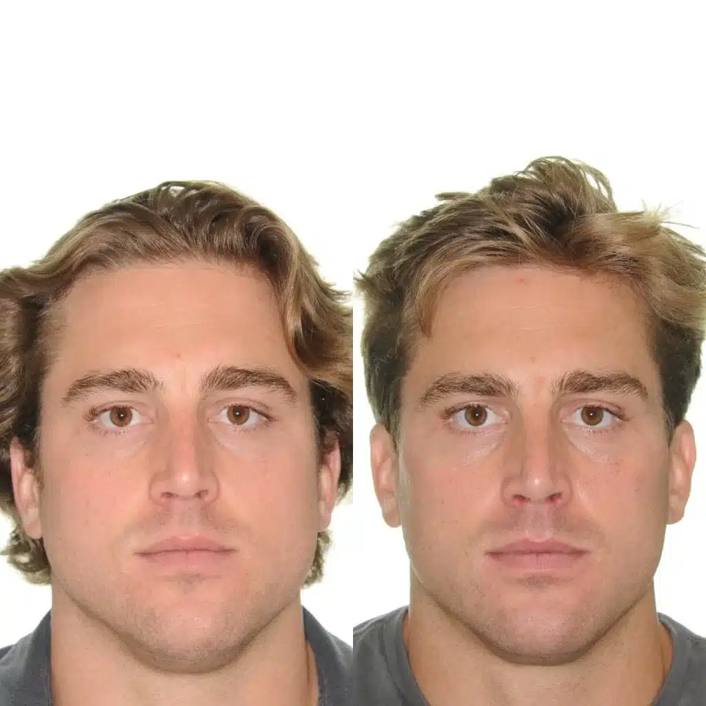 NYC Best Orthodontist 13.jpg