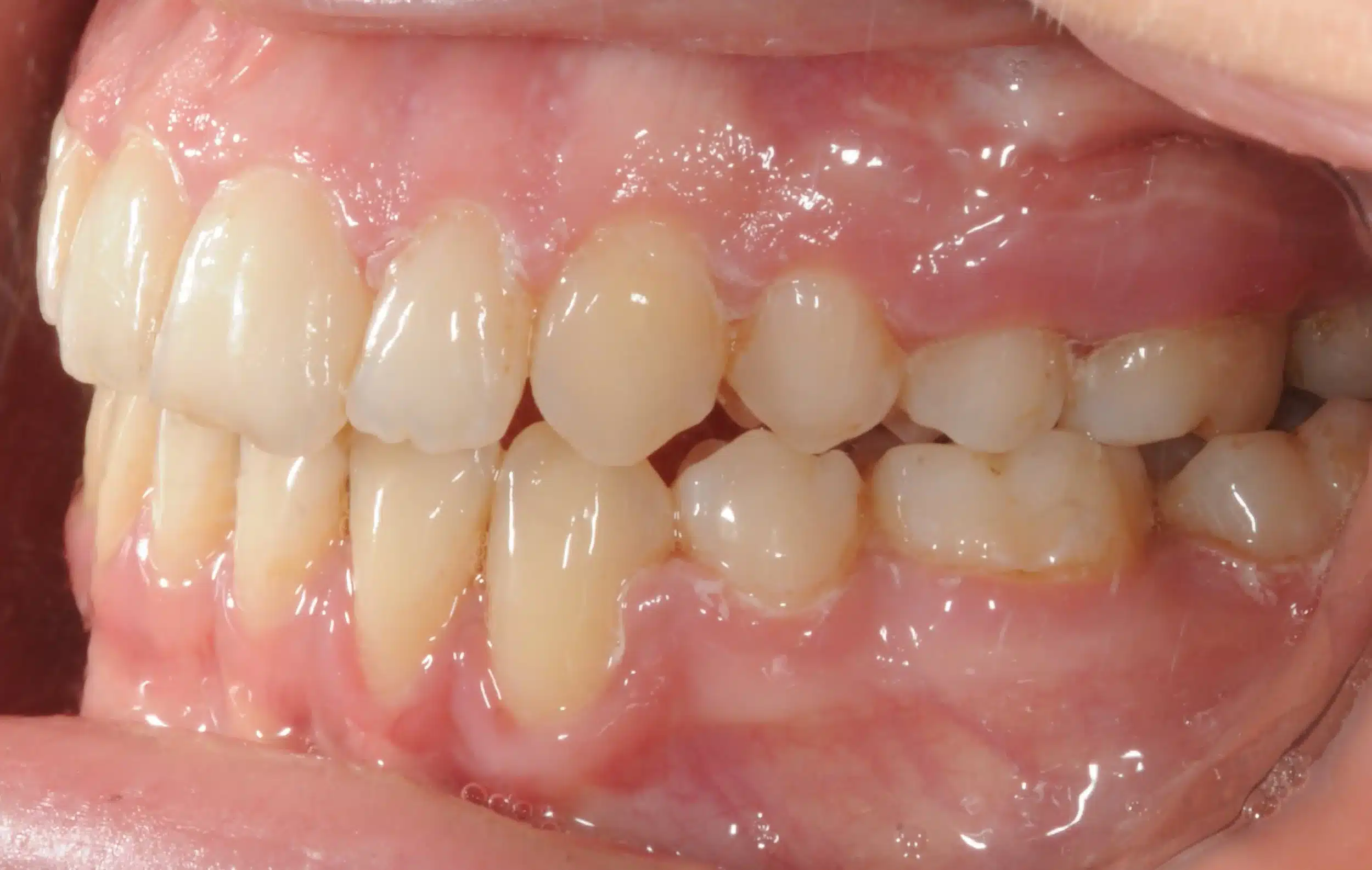 NYC Best Orthodontist 13.jpeg