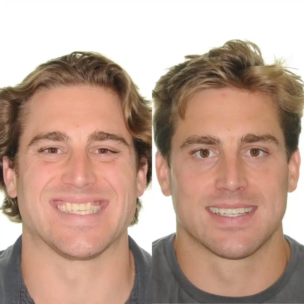 NYC Best Orthodontist 14.jpg