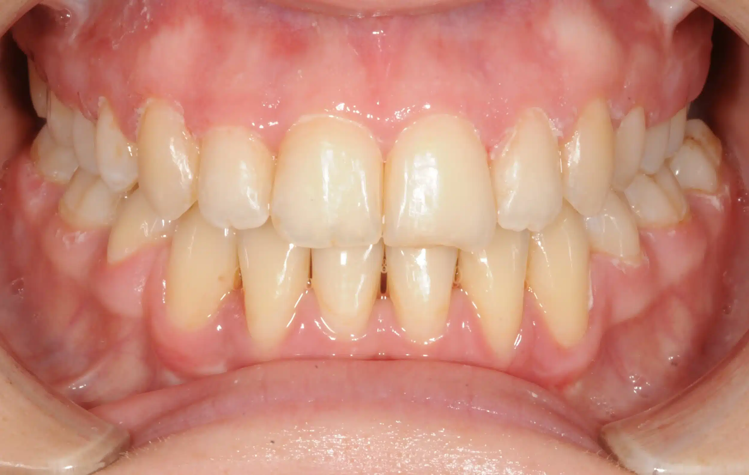 NYC Best Orthodontist 15.jpeg