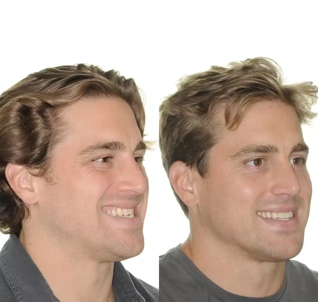 NYC Best Orthodontist 15.jpg