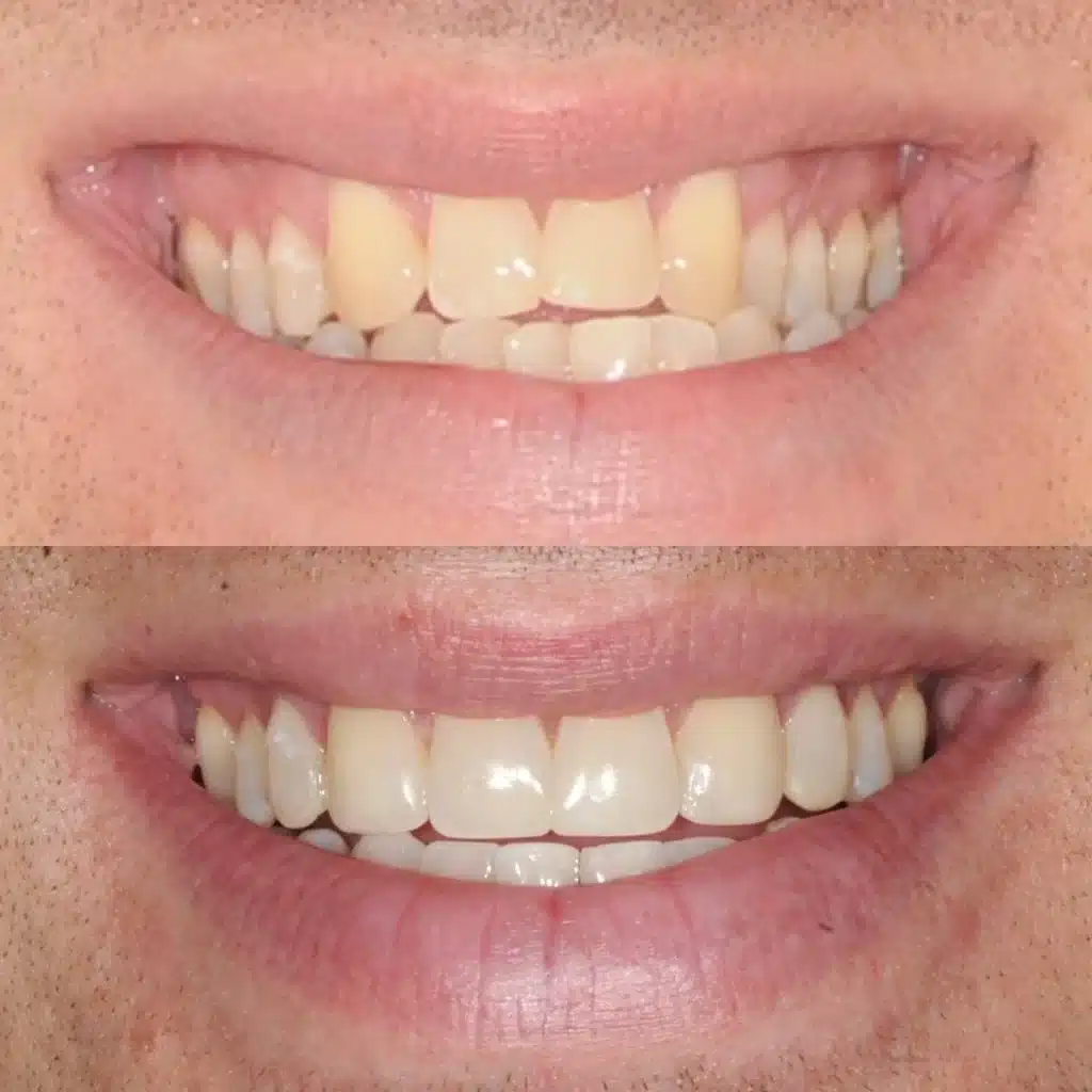 NYC Best Orthodontist 17.jpg