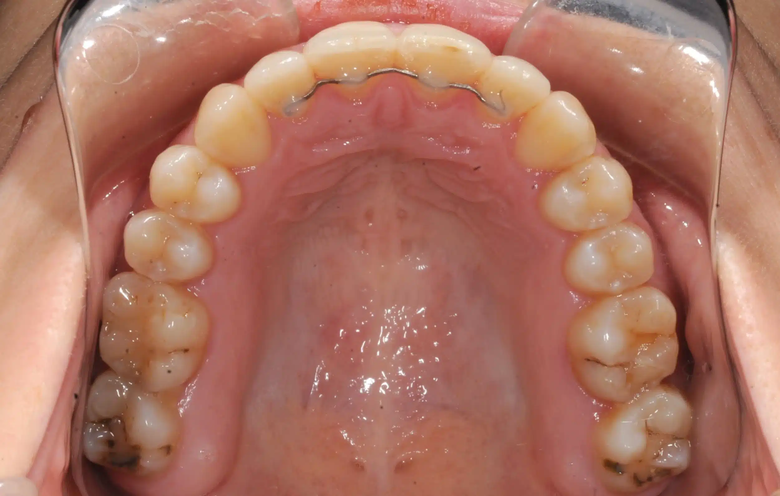 NYC Best Orthodontist 19.jpeg