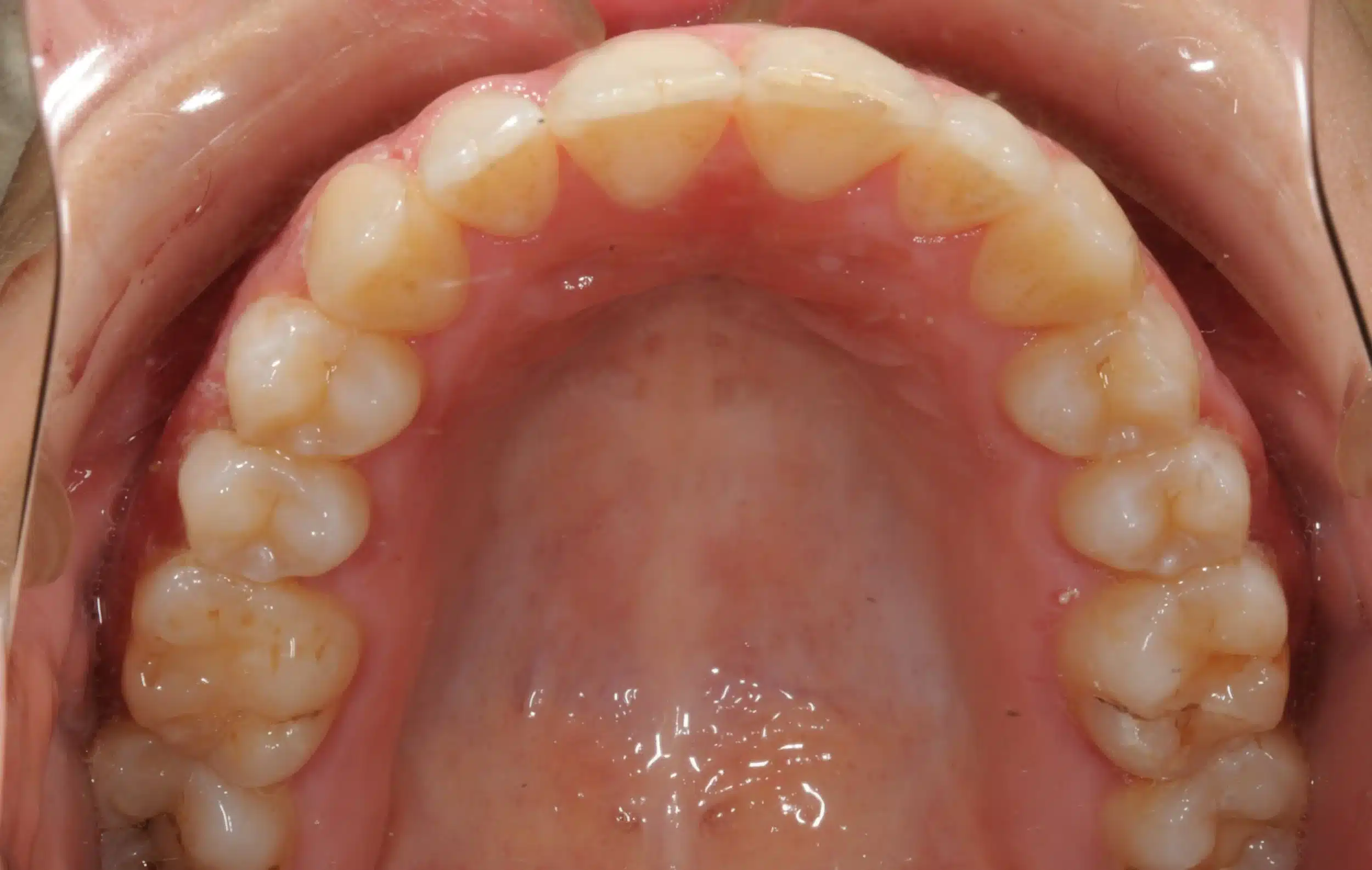 NYC Best Orthodontist 2jpeg.jpeg