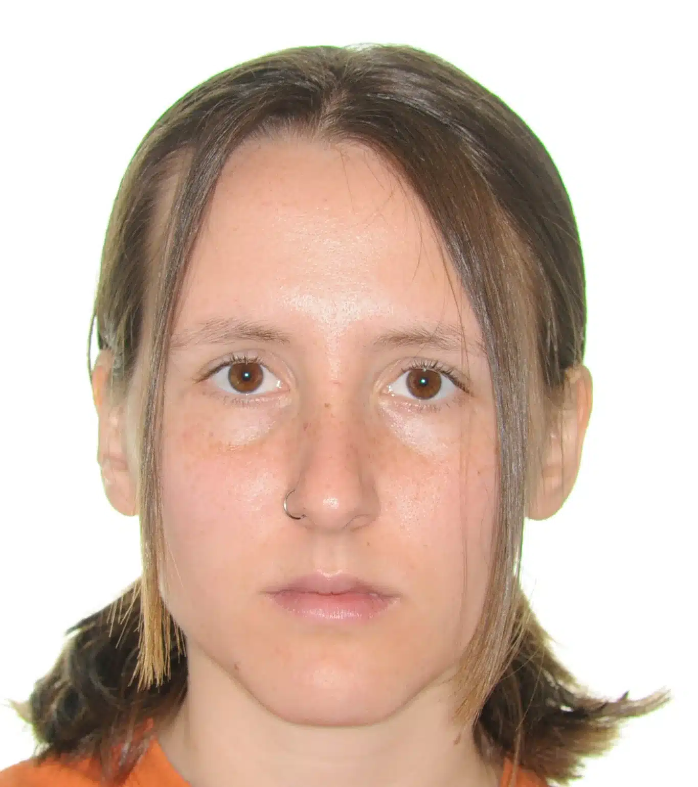 NYC Best Orthodontist 3 .jpeg