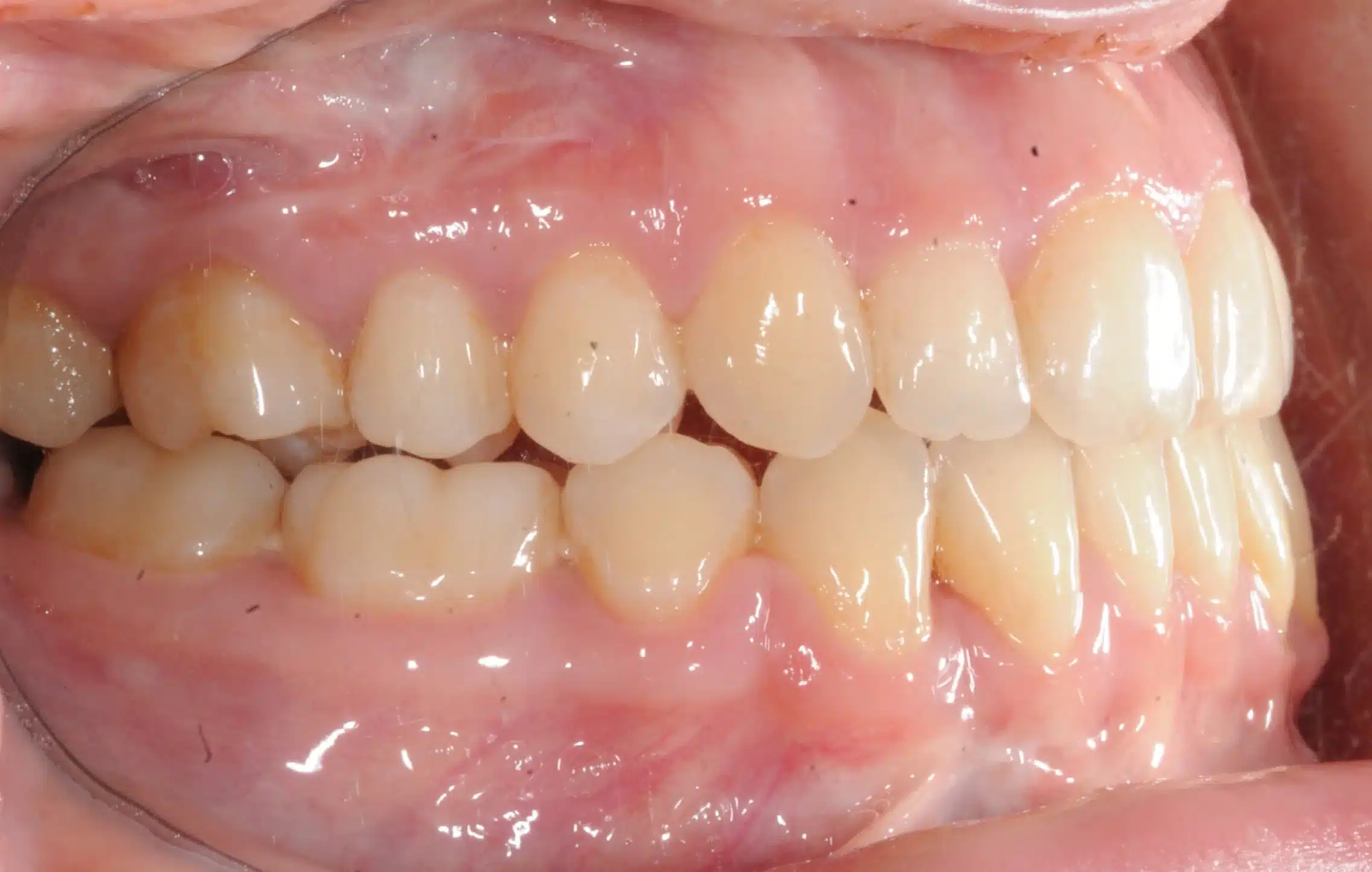 NYC Best Orthodontist 4.jpeg