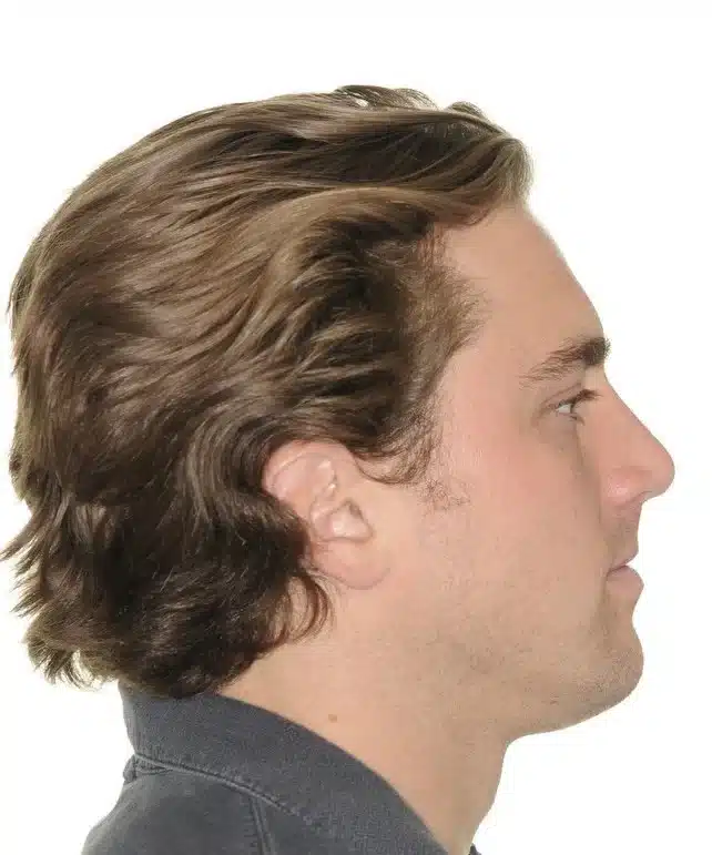 NYC Best Orthodontist 4.jpg