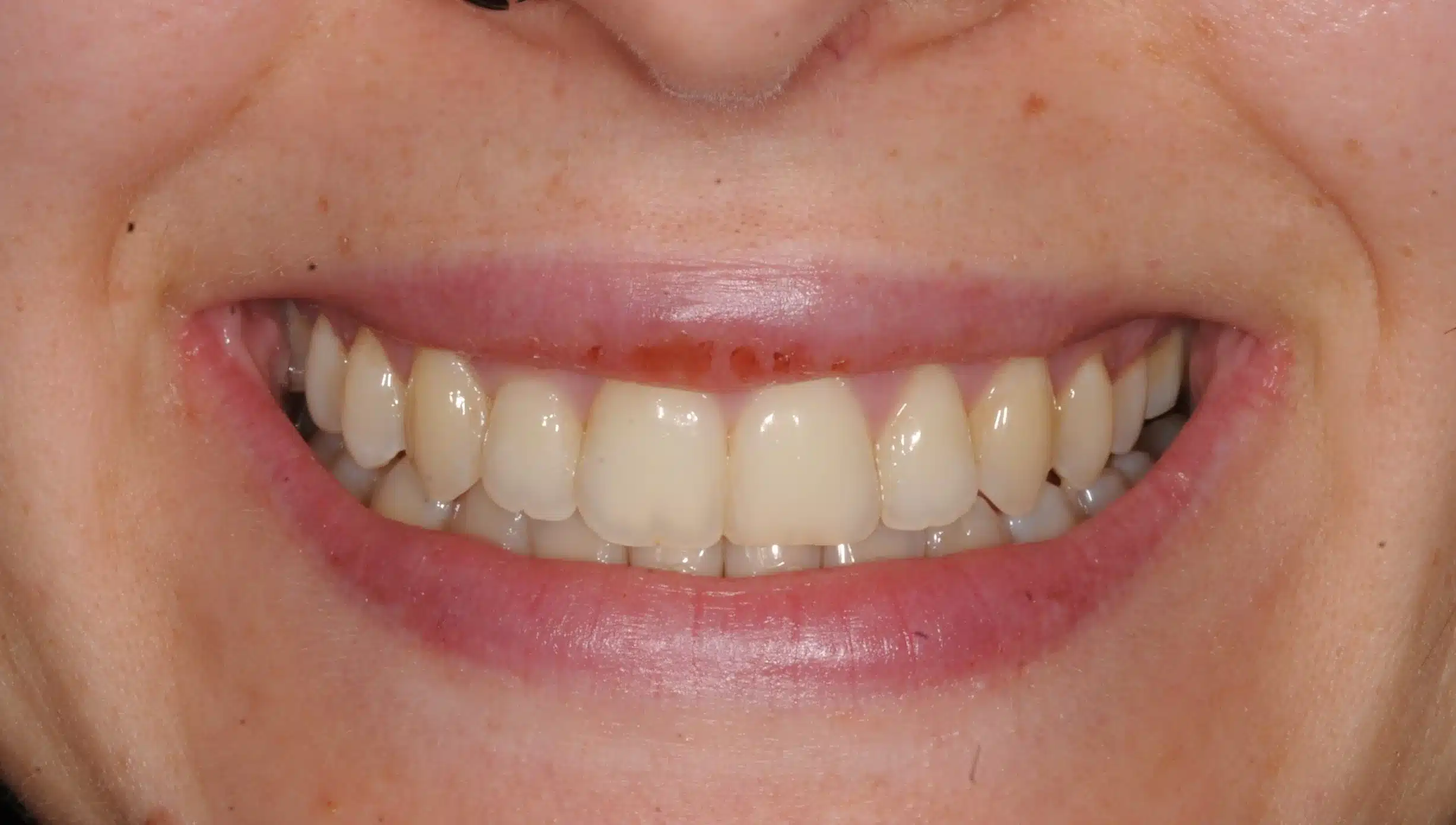 NYC Best Orthodontist 6.jpeg
